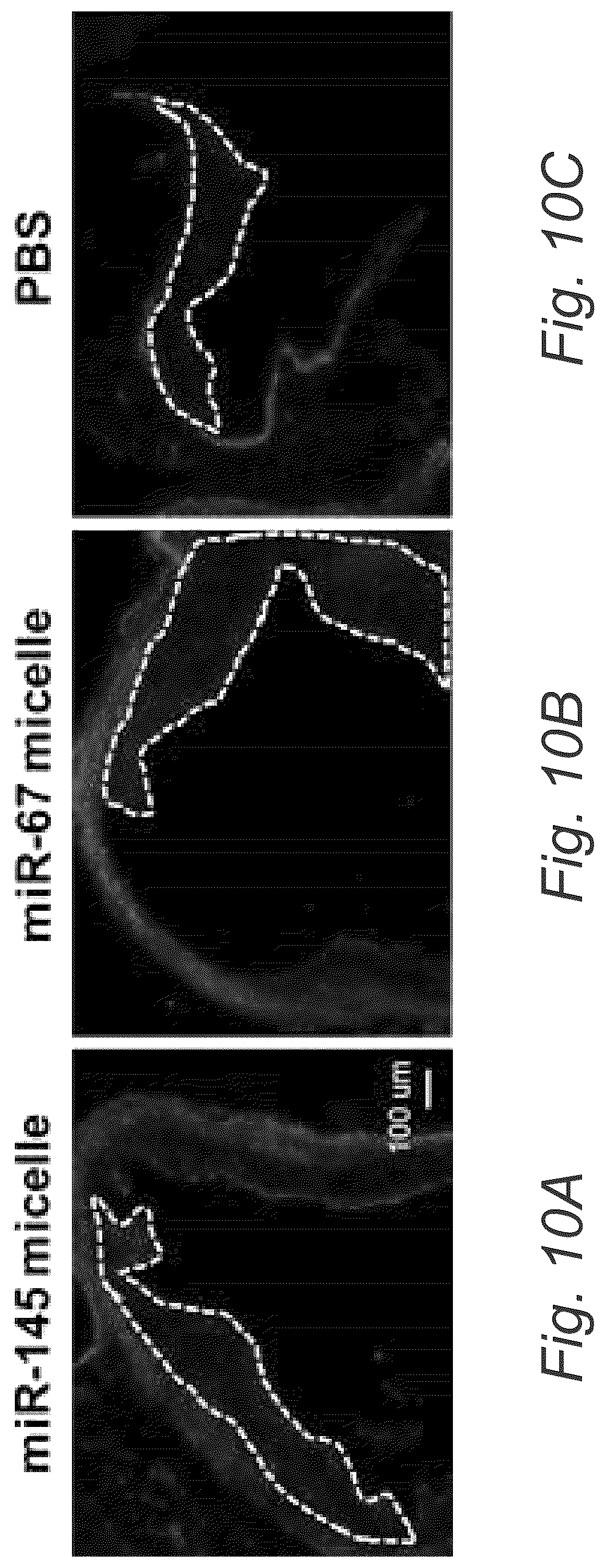 Patent US12508322 Figure 16 – MIR-145 micelles for mitigating atherosclerosis
