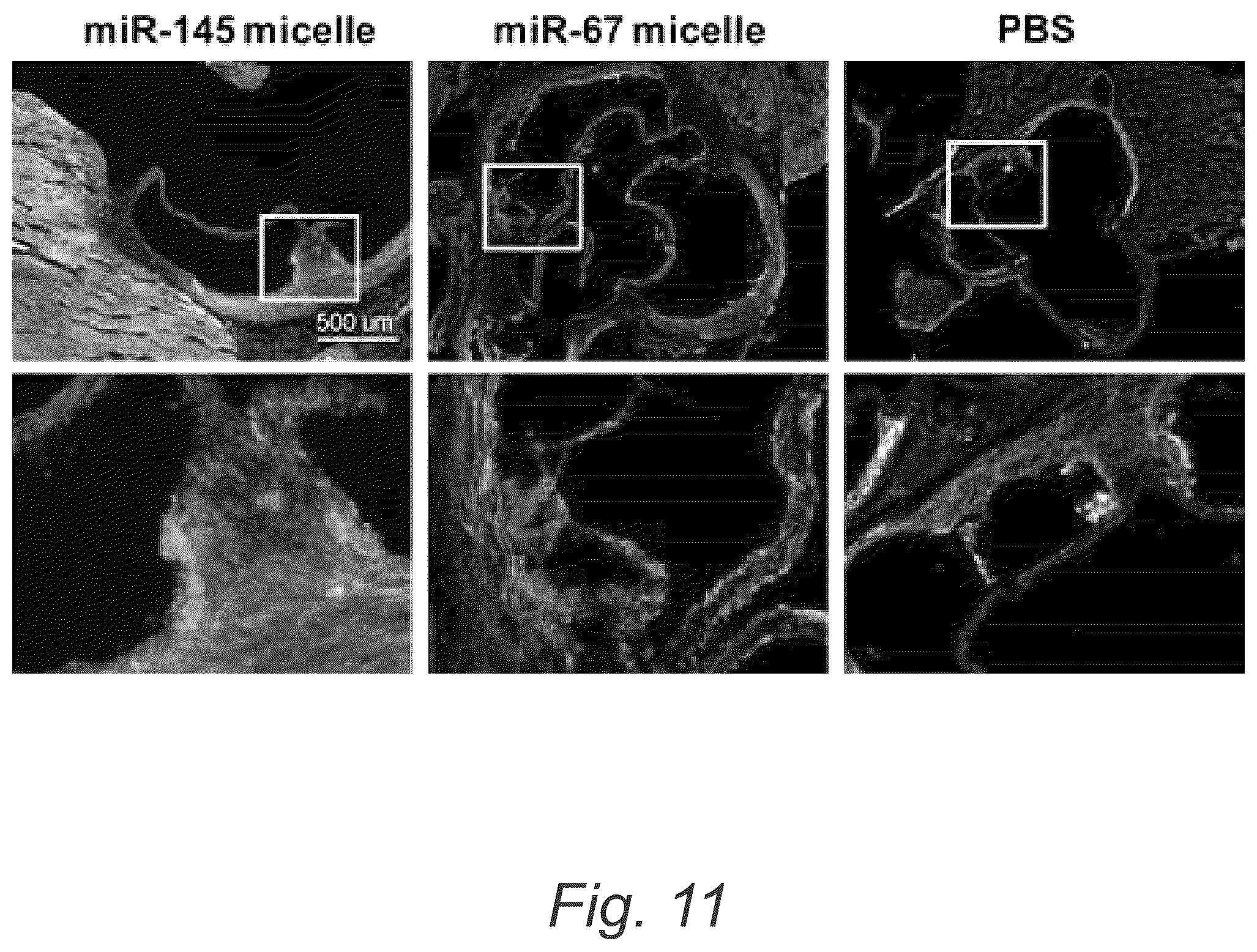 Patent US12508322 Figure 17 – MIR-145 micelles for mitigating atherosclerosis