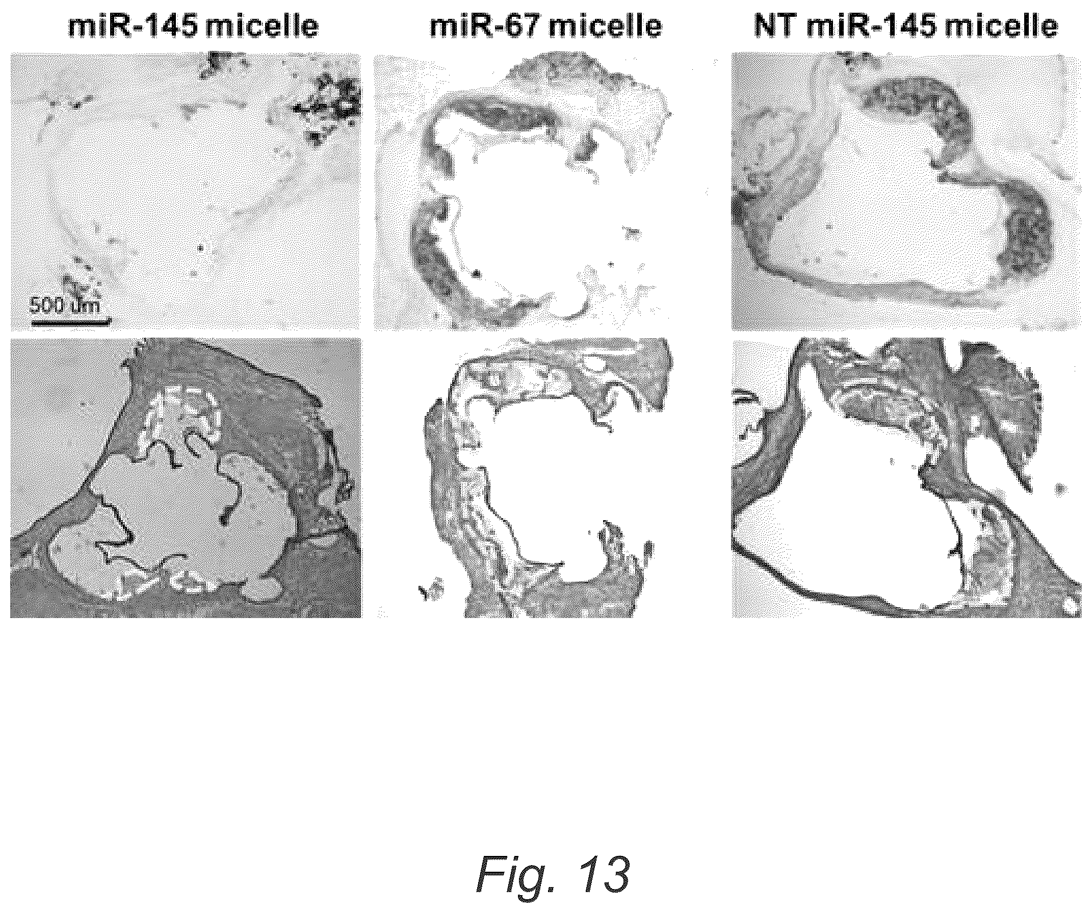 Patent US12508322 Figure 19 – MIR-145 micelles for mitigating atherosclerosis