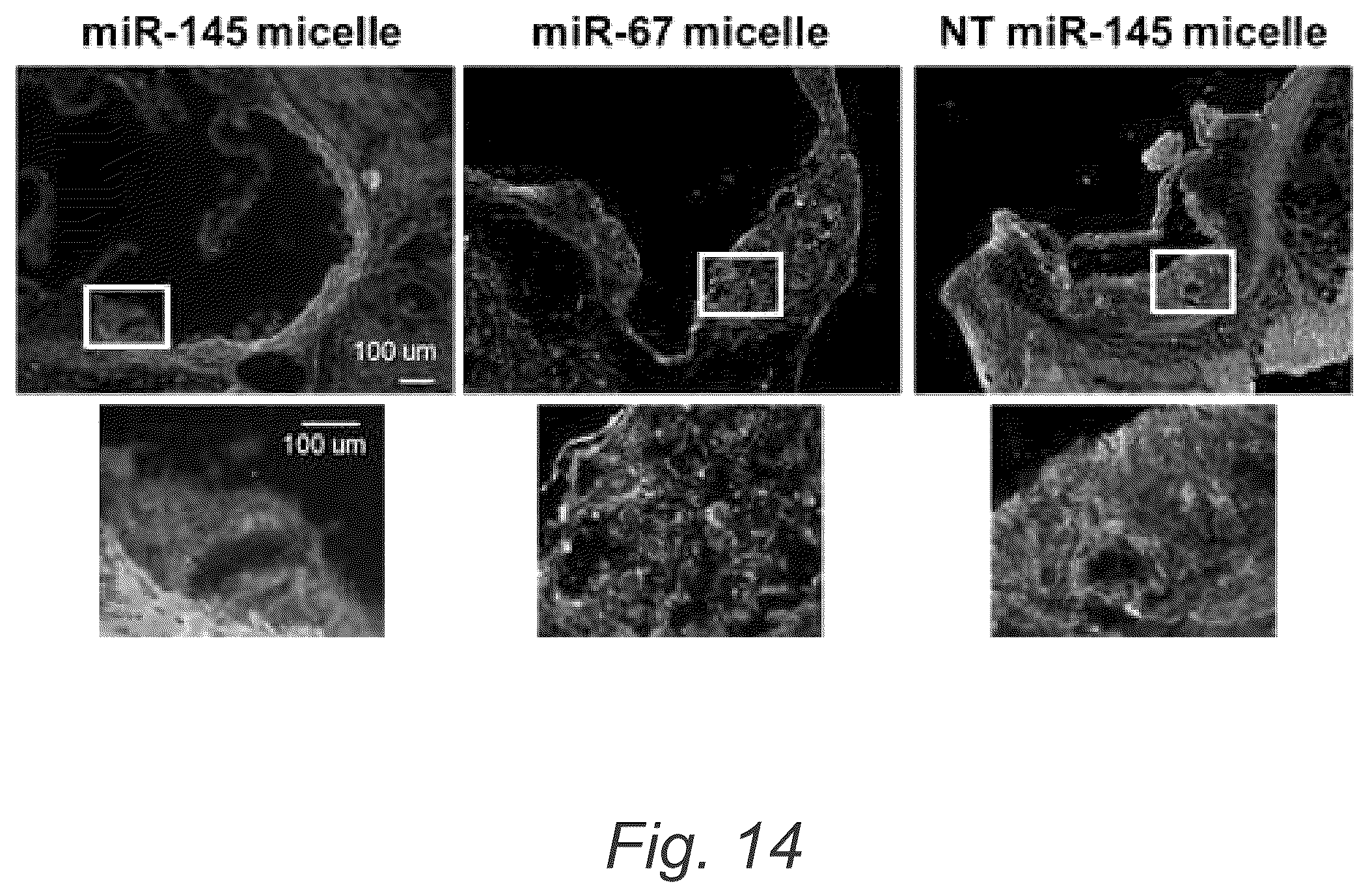 Patent US12508322 Figure 20 – MIR-145 micelles for mitigating atherosclerosis