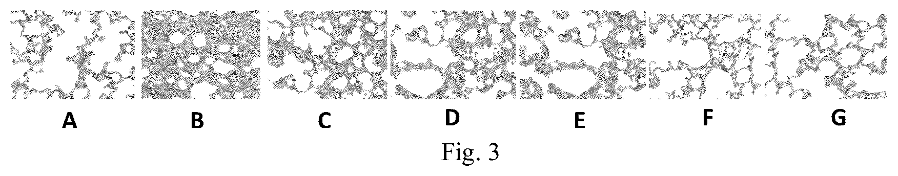 Patent US12508323 Figure 3 – Method of treatment of colorectal, breast and lung cancer with metal containing immune agonist complexes