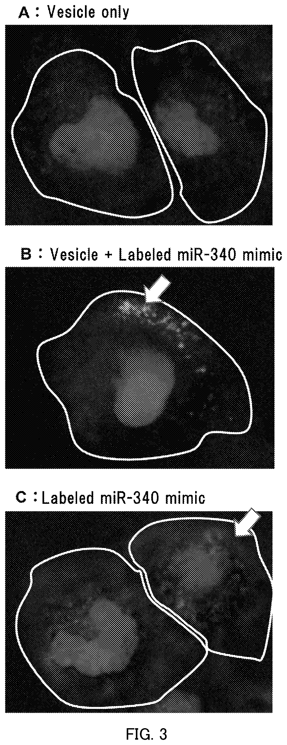 Patent US12508326 Figure 2 – Nucleic acid carrier and method for administering nucleic acid