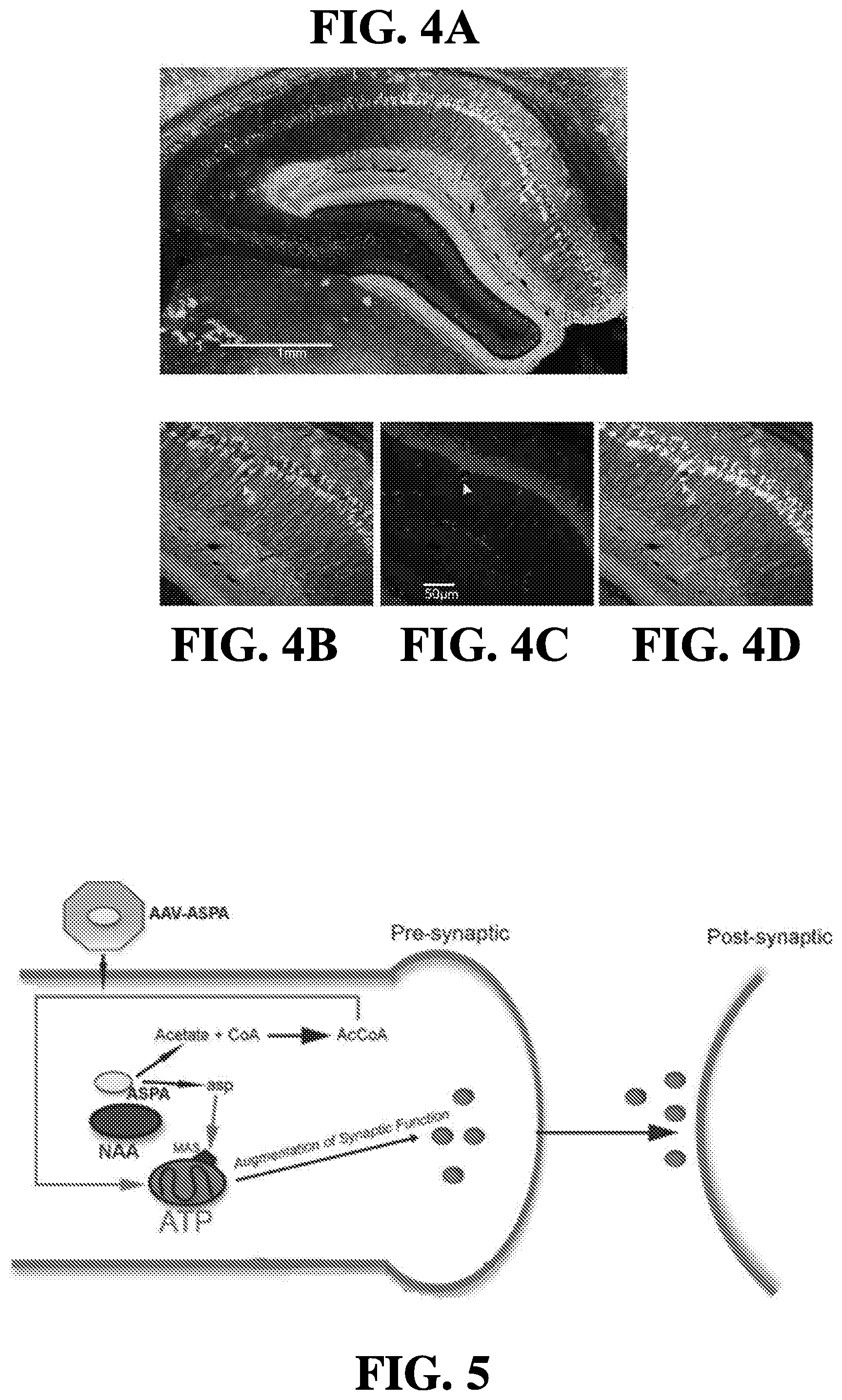 Patent US12508327 Figure 3 – Methods of treating or preventing amyotrophic lateral sclerosis