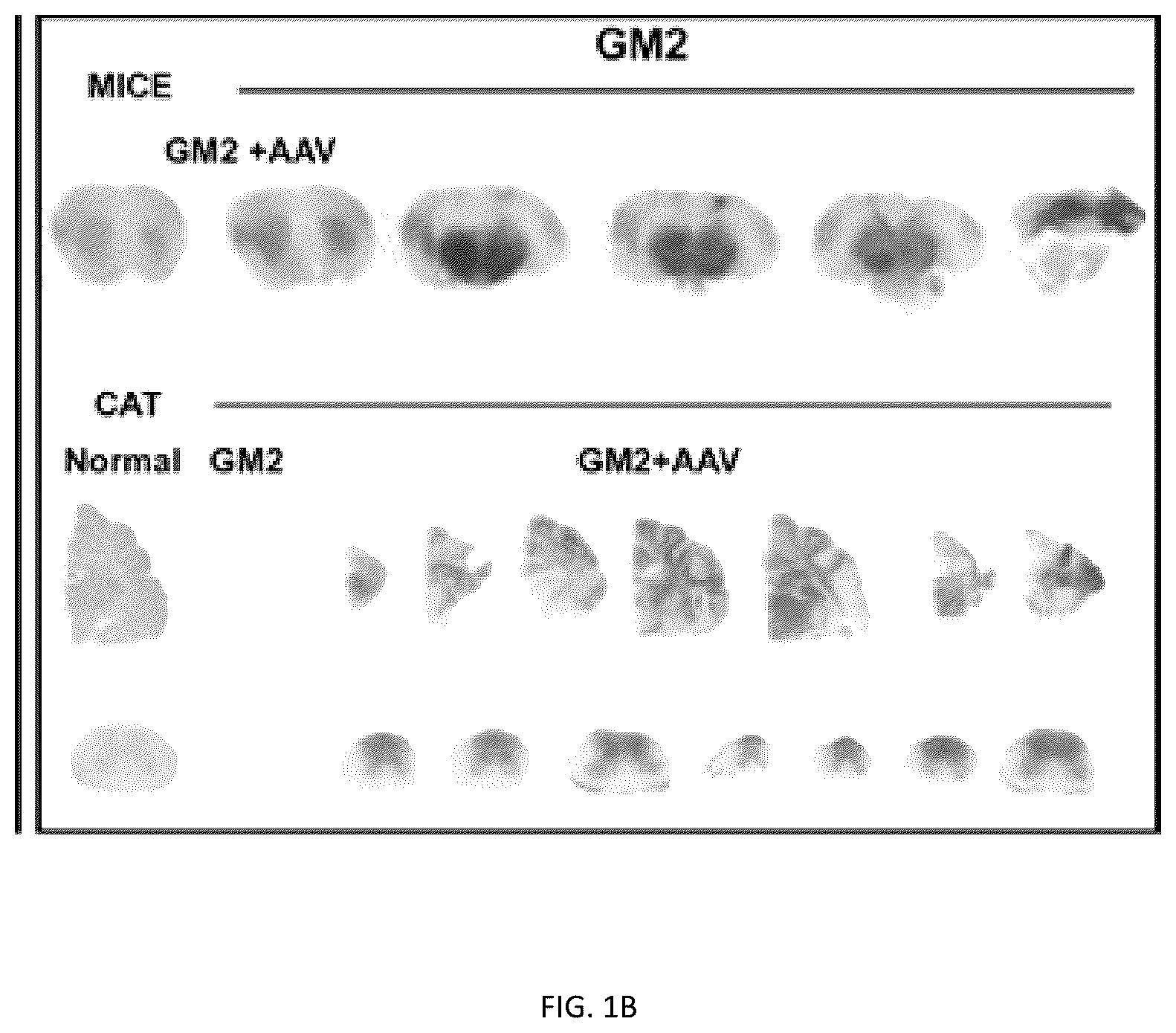 Patent US12508328 Figure 2 – Bio-activated reporters to visualize, in real time, specific gene therapy products