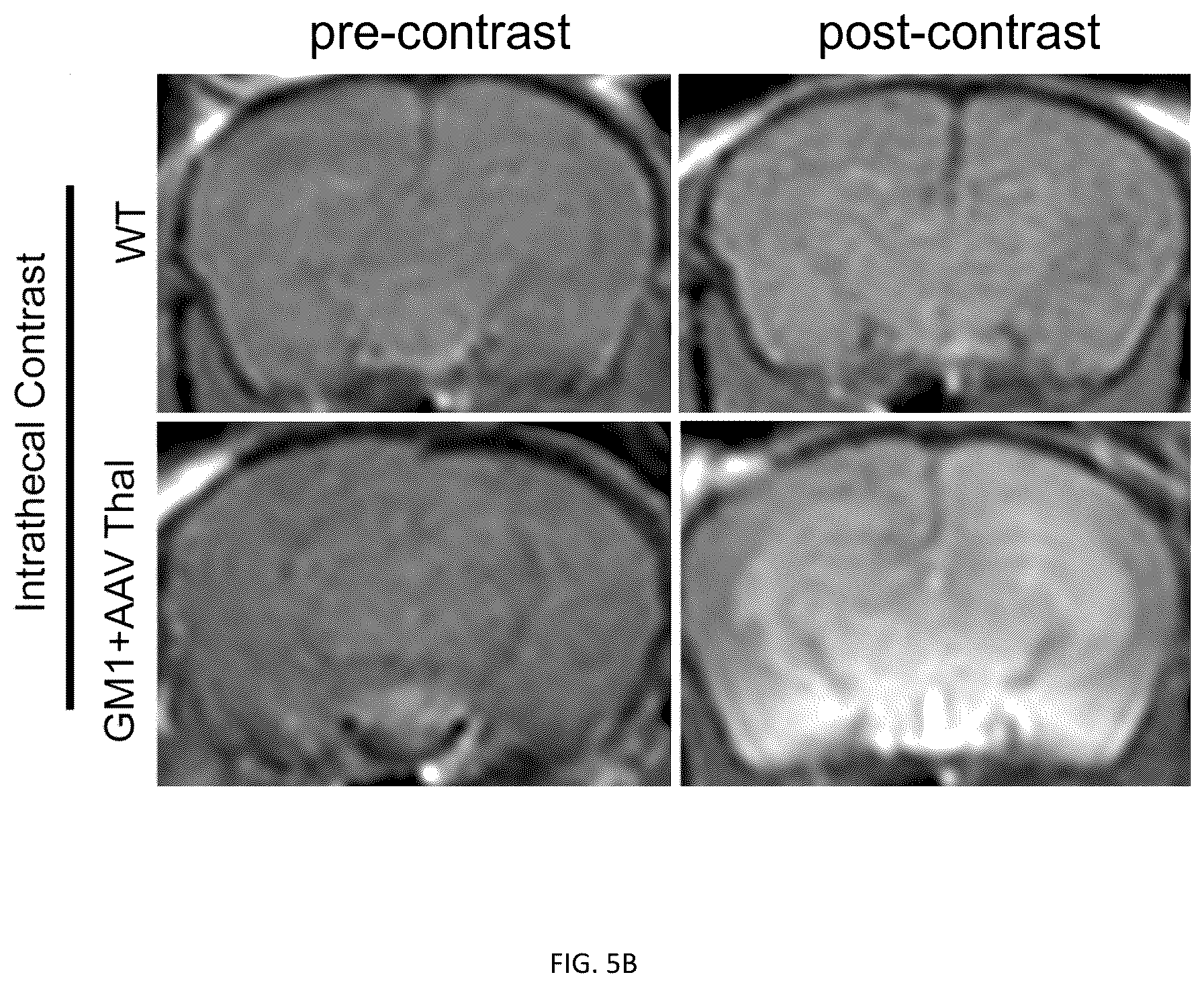 Patent US12508328 Figure 7 – Bio-activated reporters to visualize, in real time, specific gene therapy products