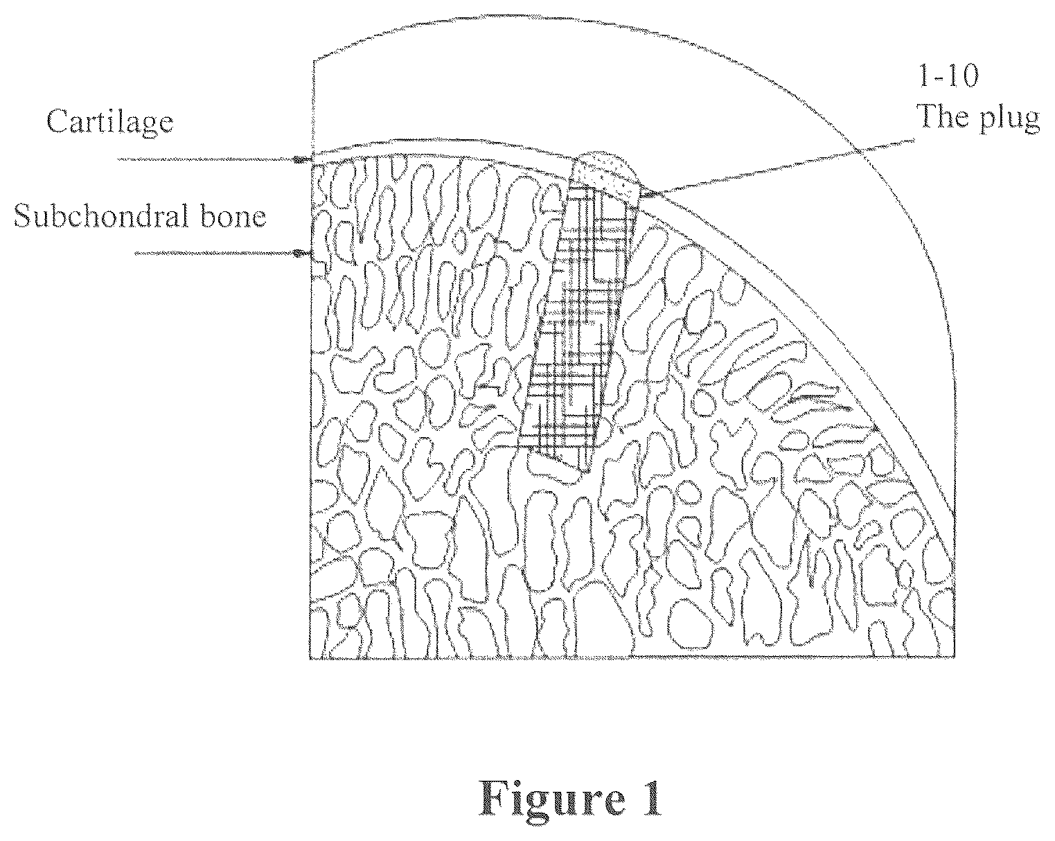 Patent US12508343 Figure 1 – Solid forms for tissue repair