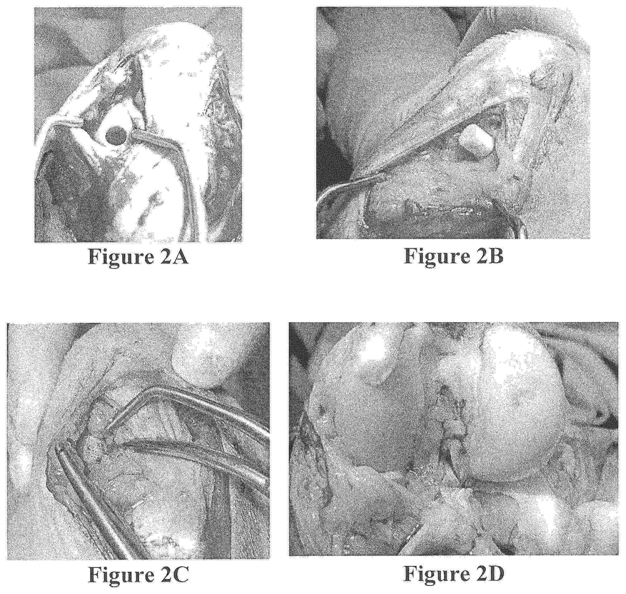 Patent US12508343 Figure 2 – Solid forms for tissue repair