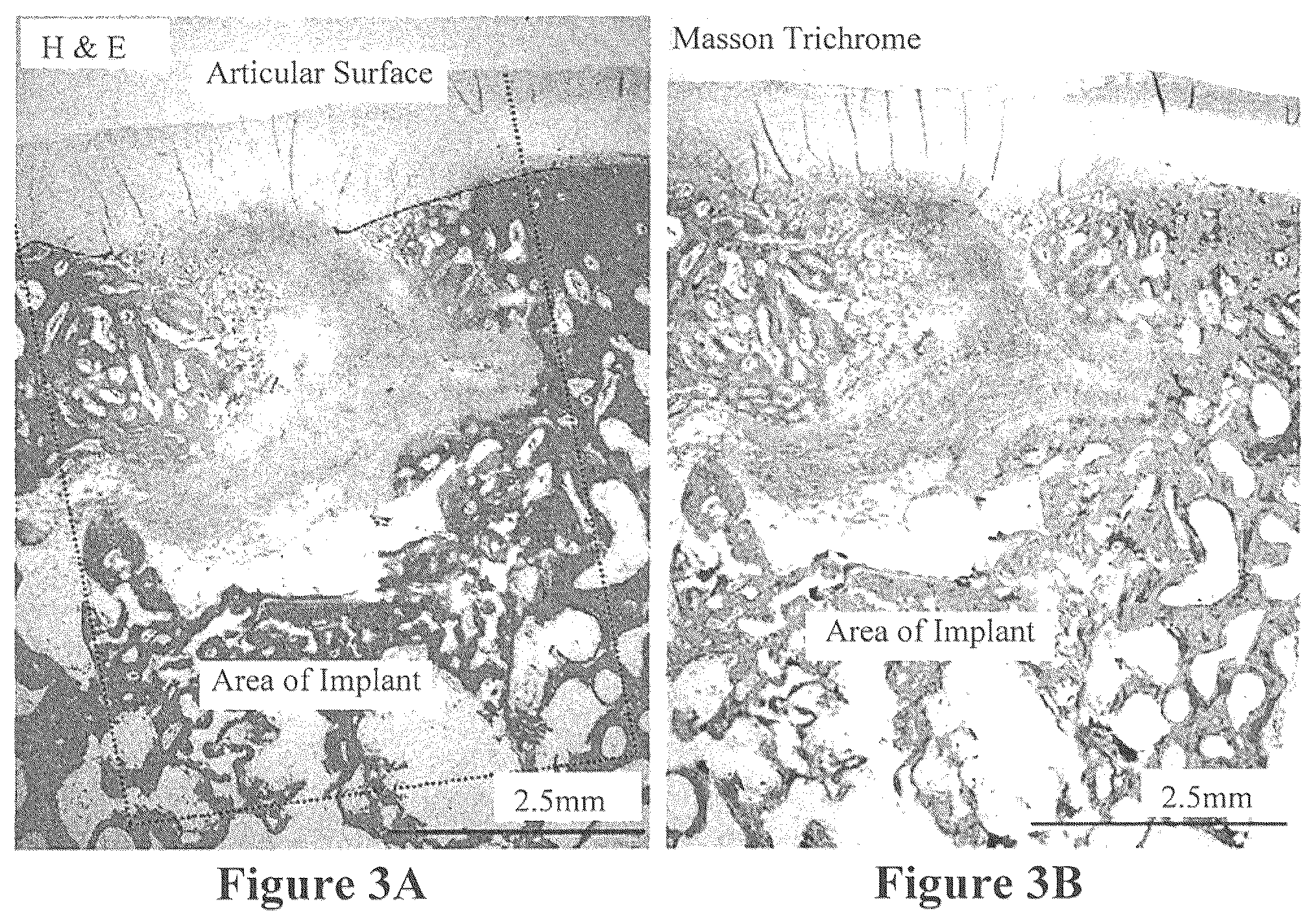 Patent US12508343 Figure 3 – Solid forms for tissue repair