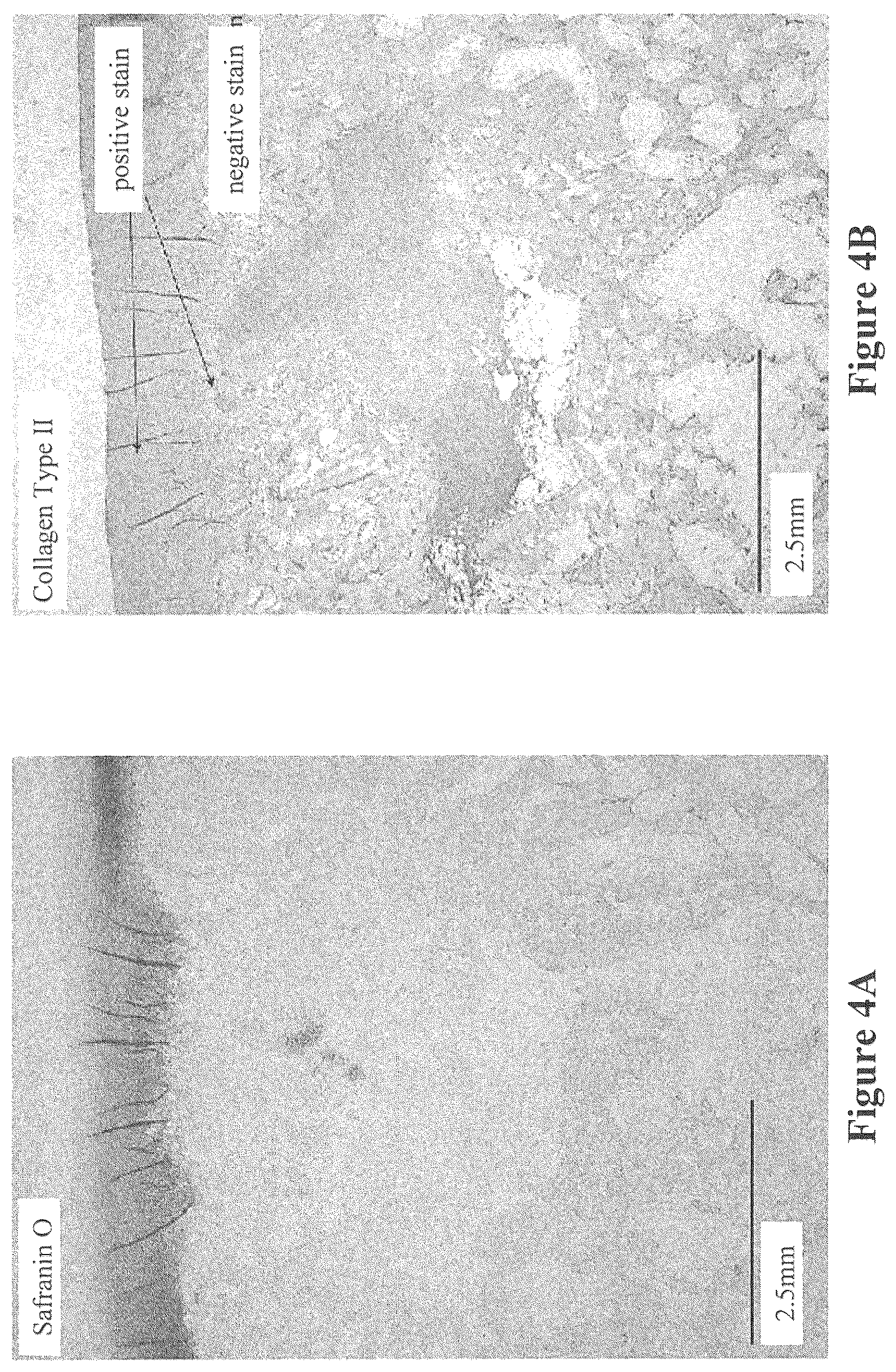 Patent US12508343 Figure 4 – Solid forms for tissue repair