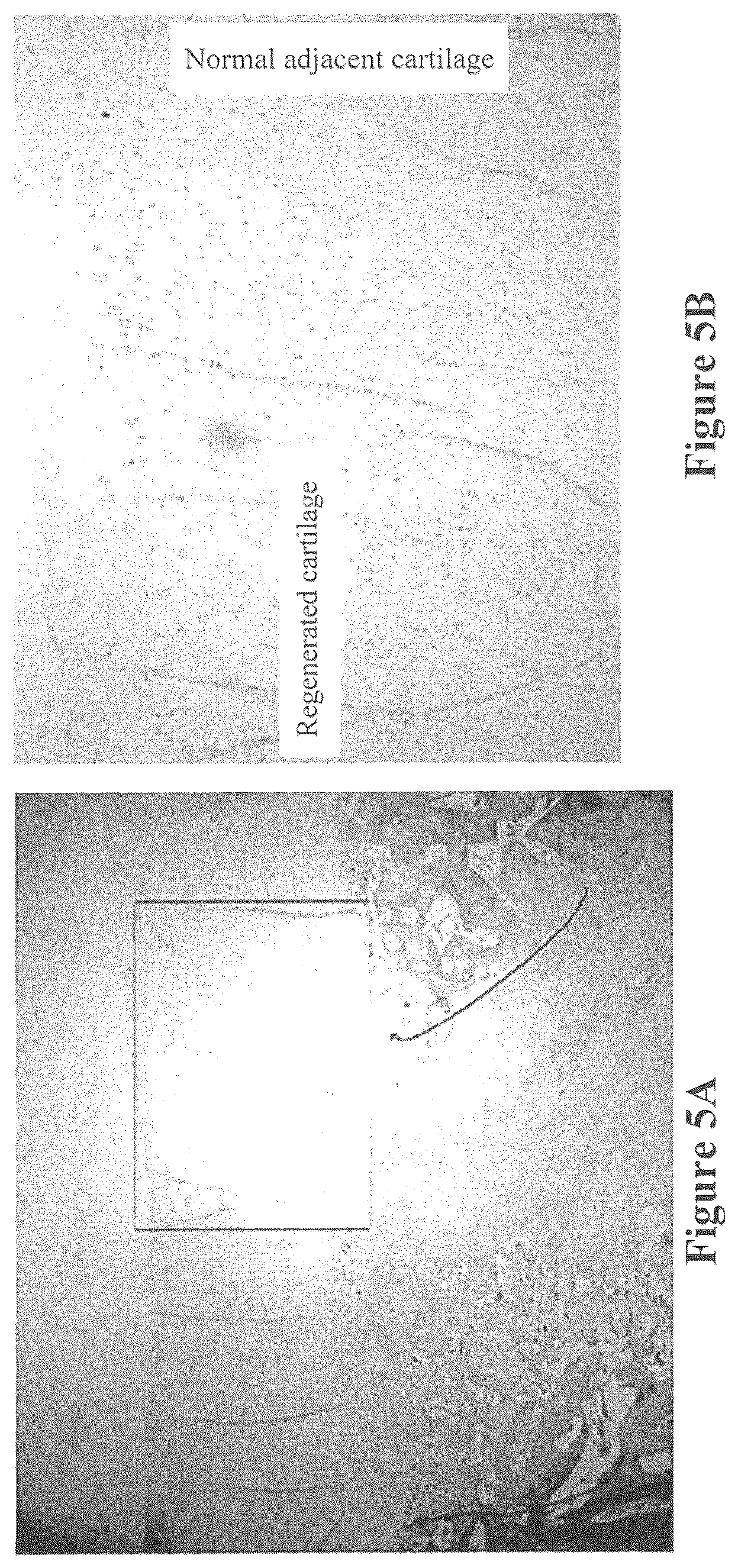 Patent US12508343 Figure 5 – Solid forms for tissue repair