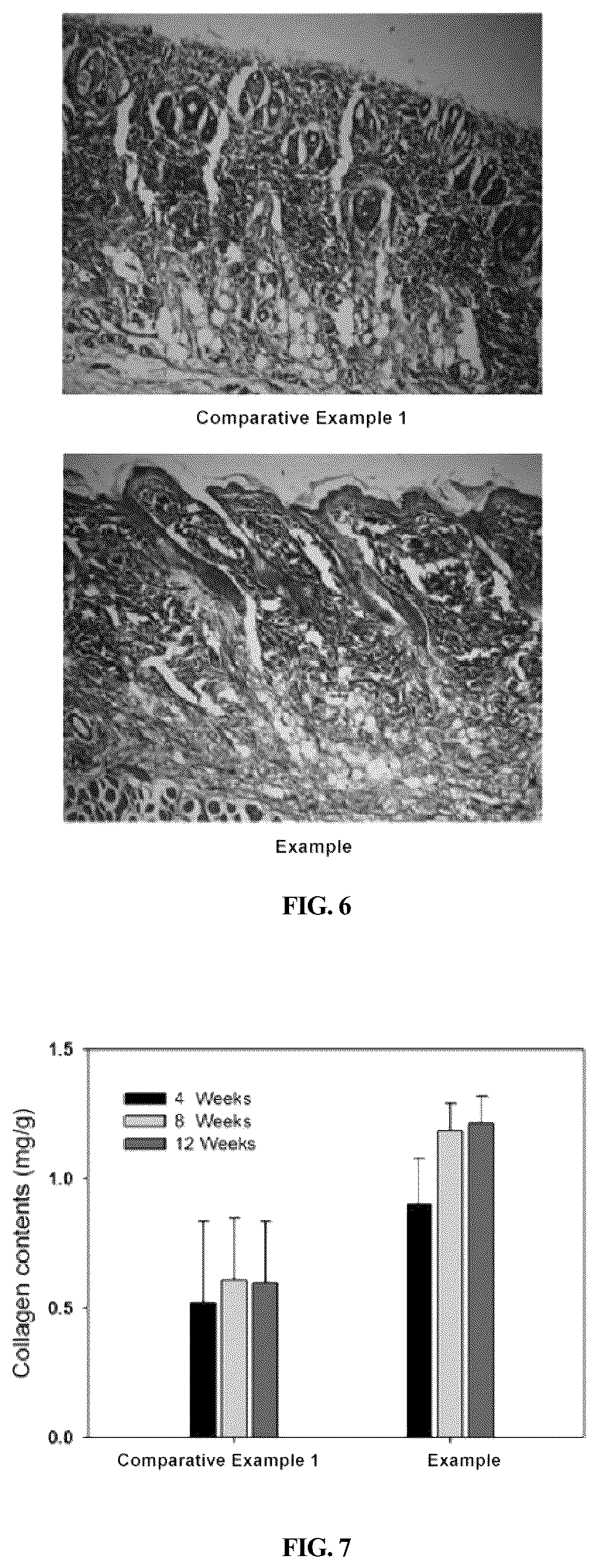 Patent US12508344 Figure 3 – Composition for restoration of tissue including biodegradable polymeric copolymer