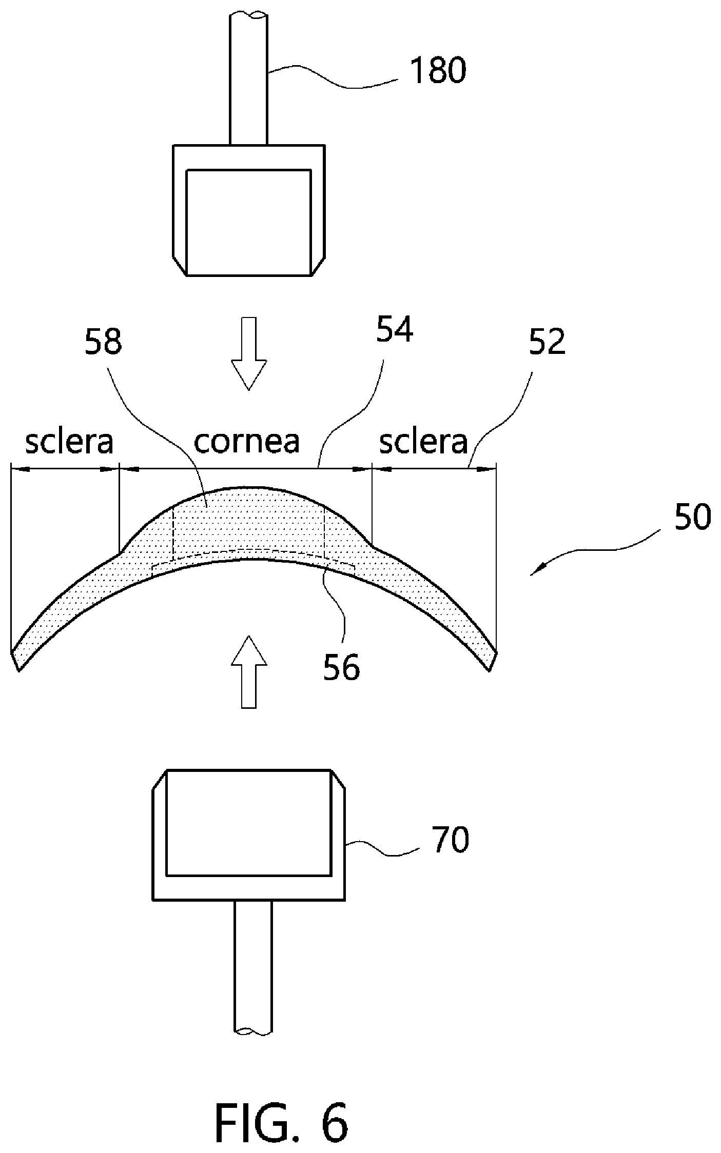 Patent US12508346 Figure 6 – Multilayer cornea harvesting apparatus and cornea harvesting method using same