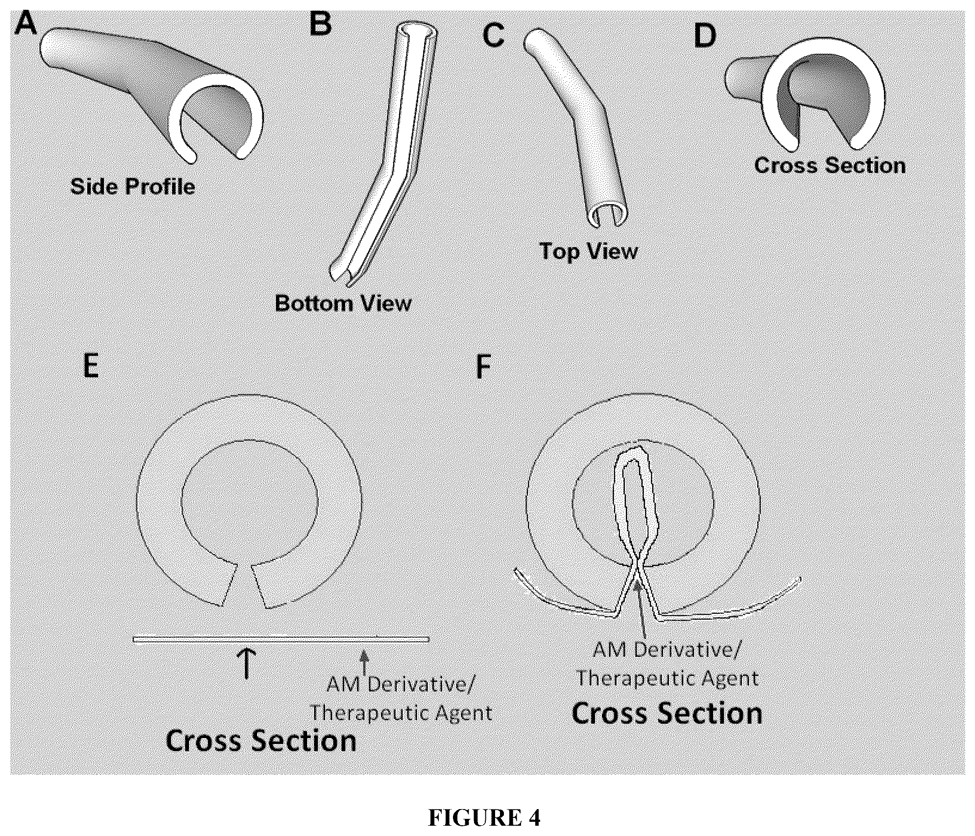 Patent US12508349 Figure 4 – Apparatuses and methods for treating ophthalmic diseases and disorders