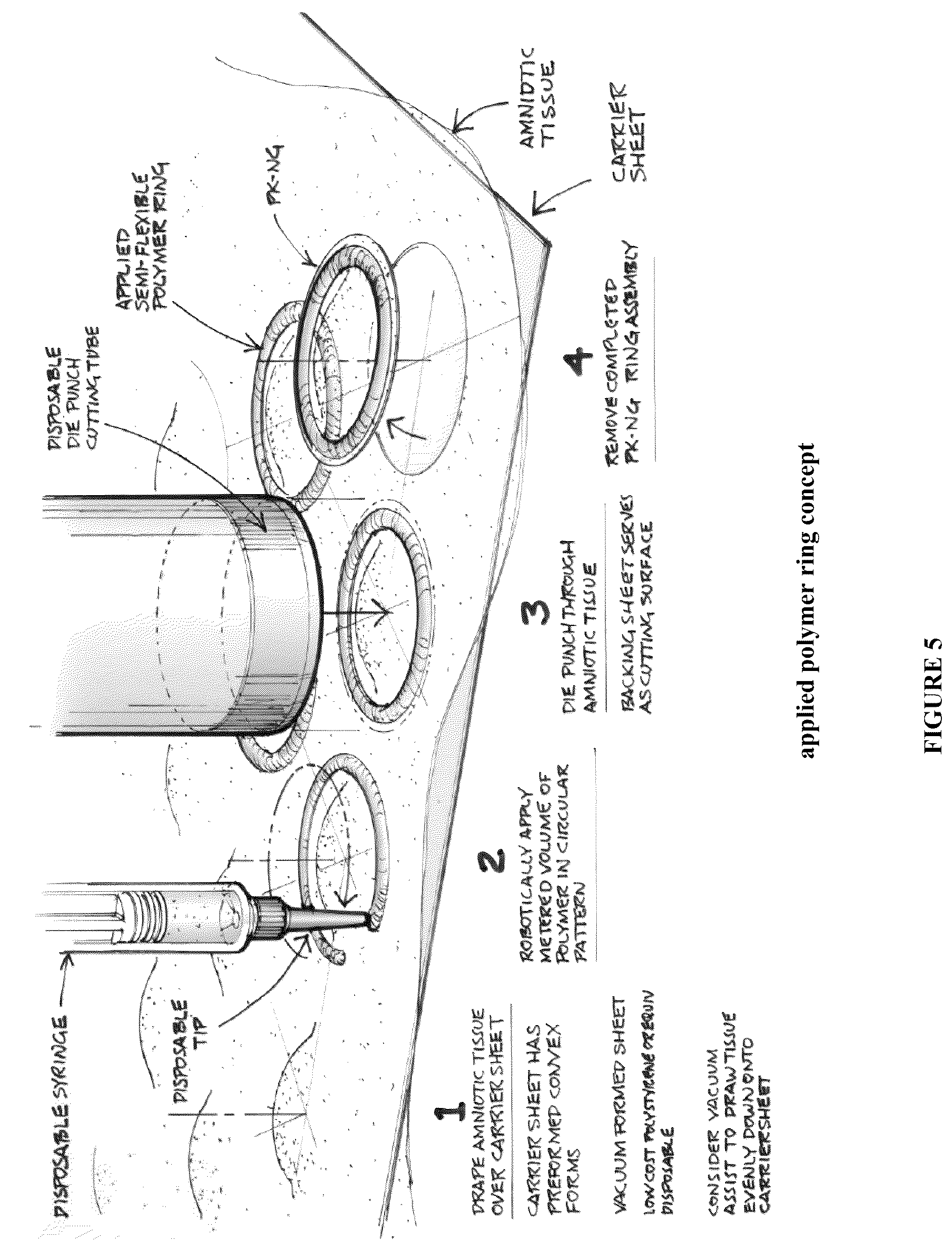 Patent US12508349 Figure 5 – Apparatuses and methods for treating ophthalmic diseases and disorders