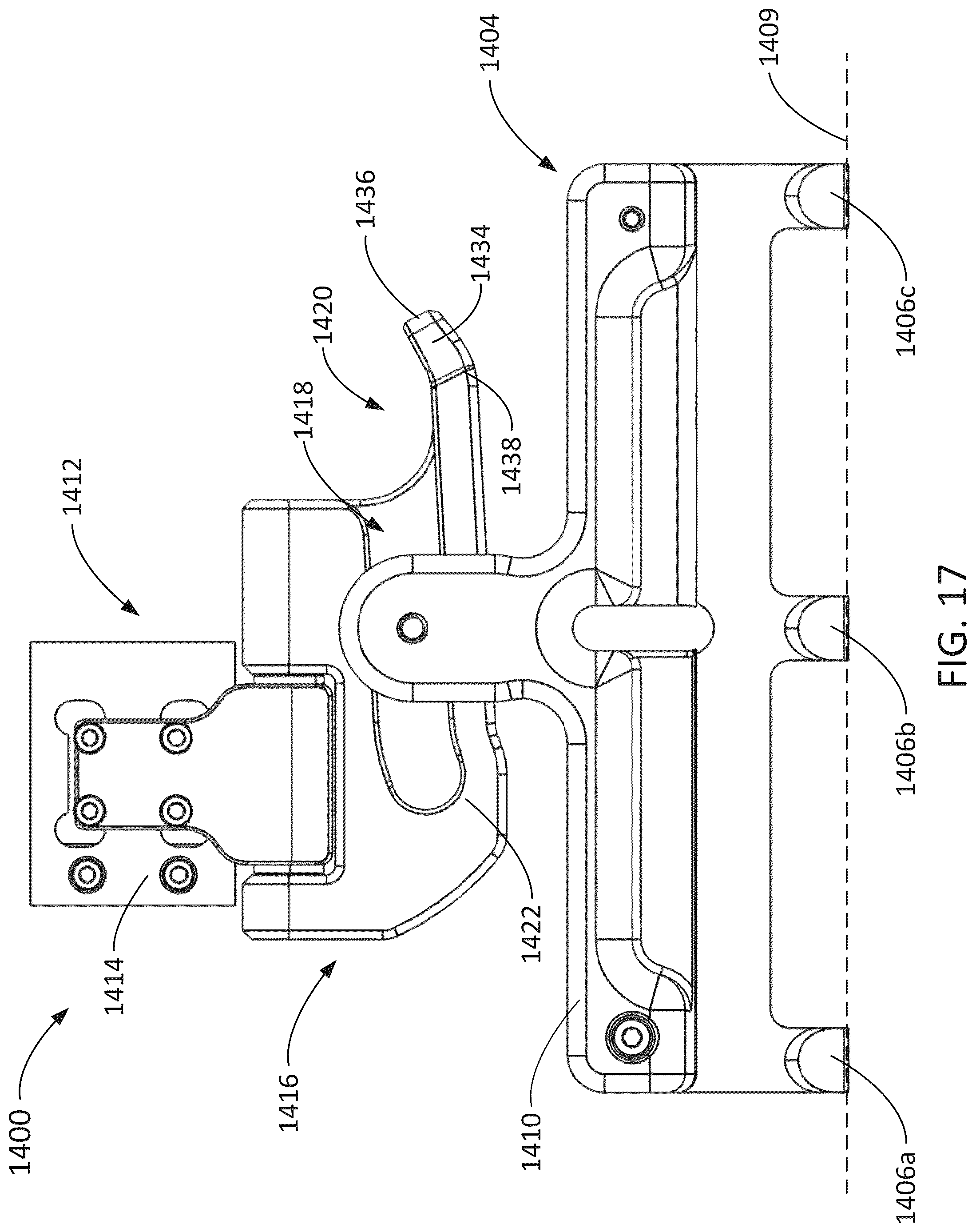 Patent US12508351 Figure 17 – Extracorporeal blood filtering machine and methods