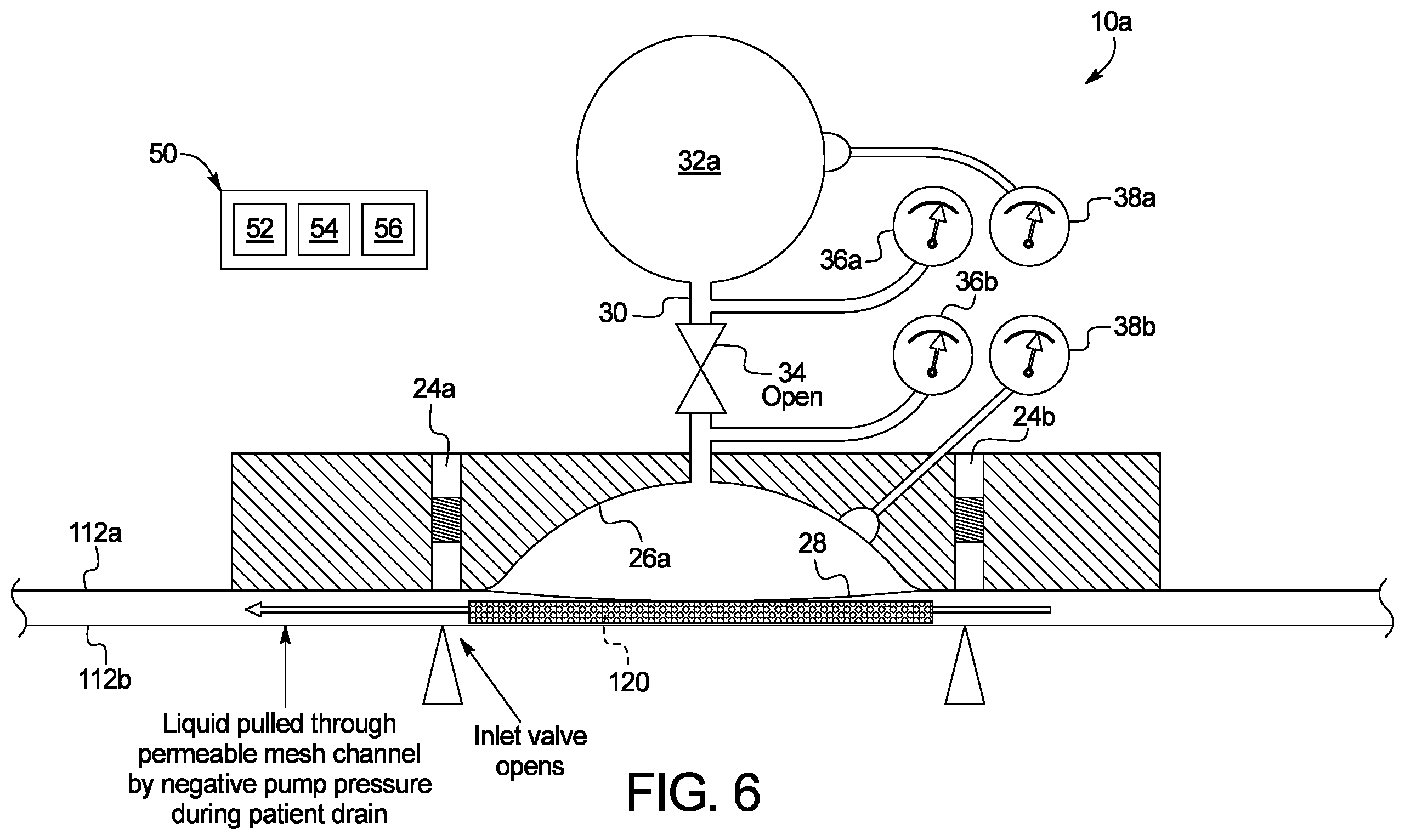 Patent US12508353 Figure 6 – Peritoneal dialysis system using ideal gas law