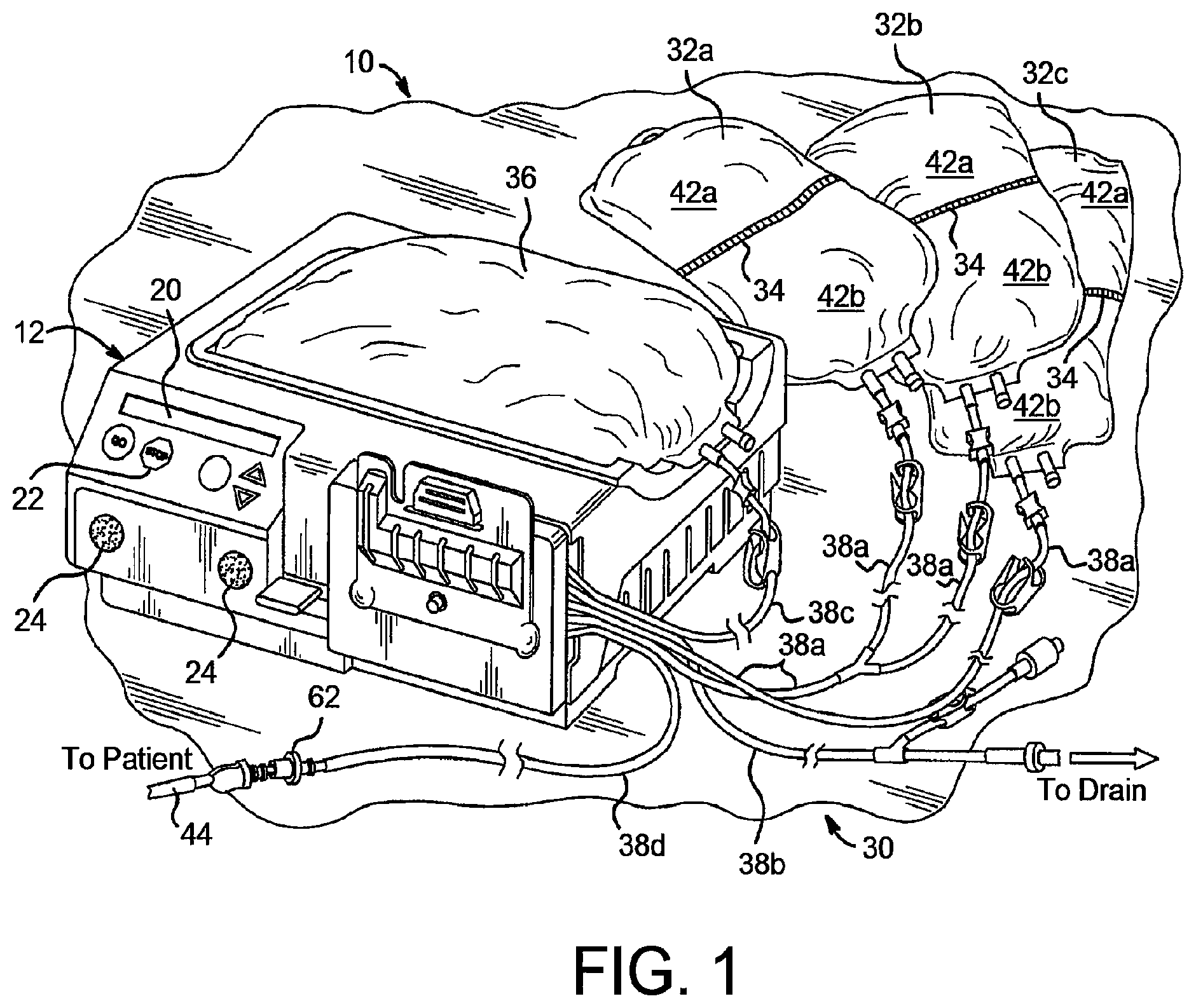 Patent US12508354 Figure 1 – Apparatus for trending automated peritoneal dialysis treatments