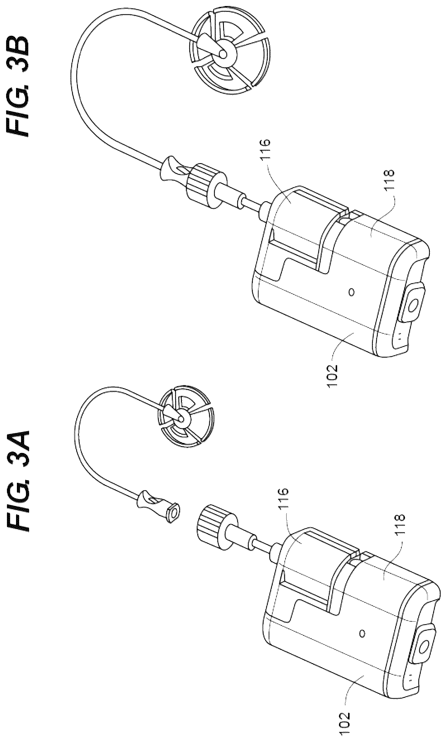 Patent US12508365 Figure 3 – Site tracking based on connectivity in infusion pump systems