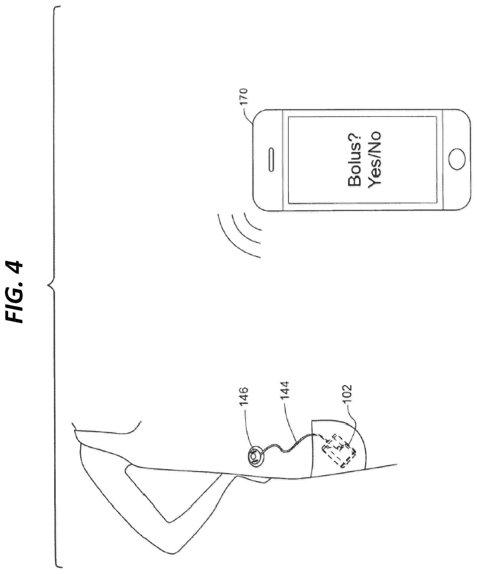 Patent US12508365 Figure 4 – Site tracking based on connectivity in infusion pump systems