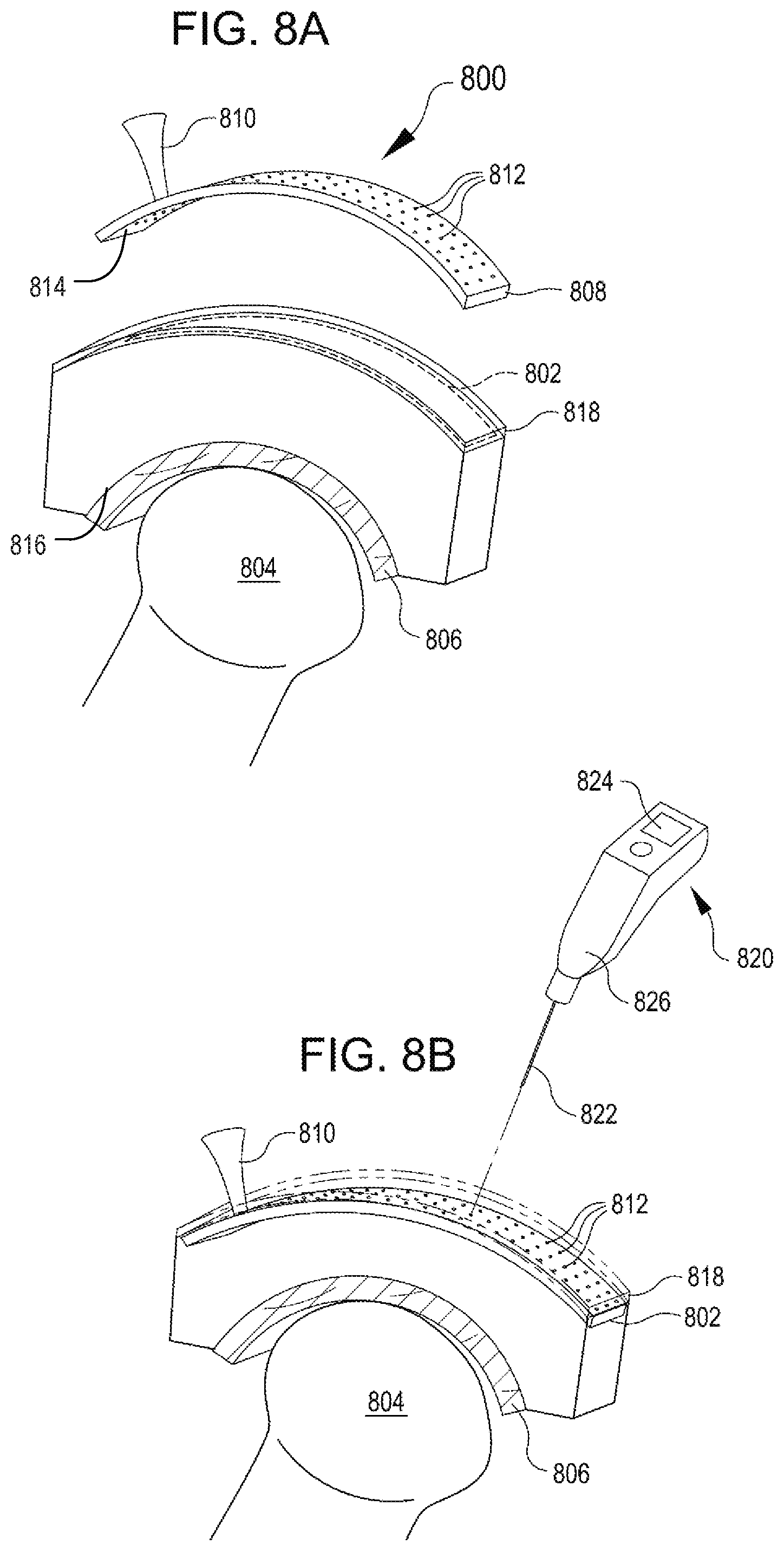 Patent US12508374 Figure 7 – Systems for inhibiting heterotopic ossification