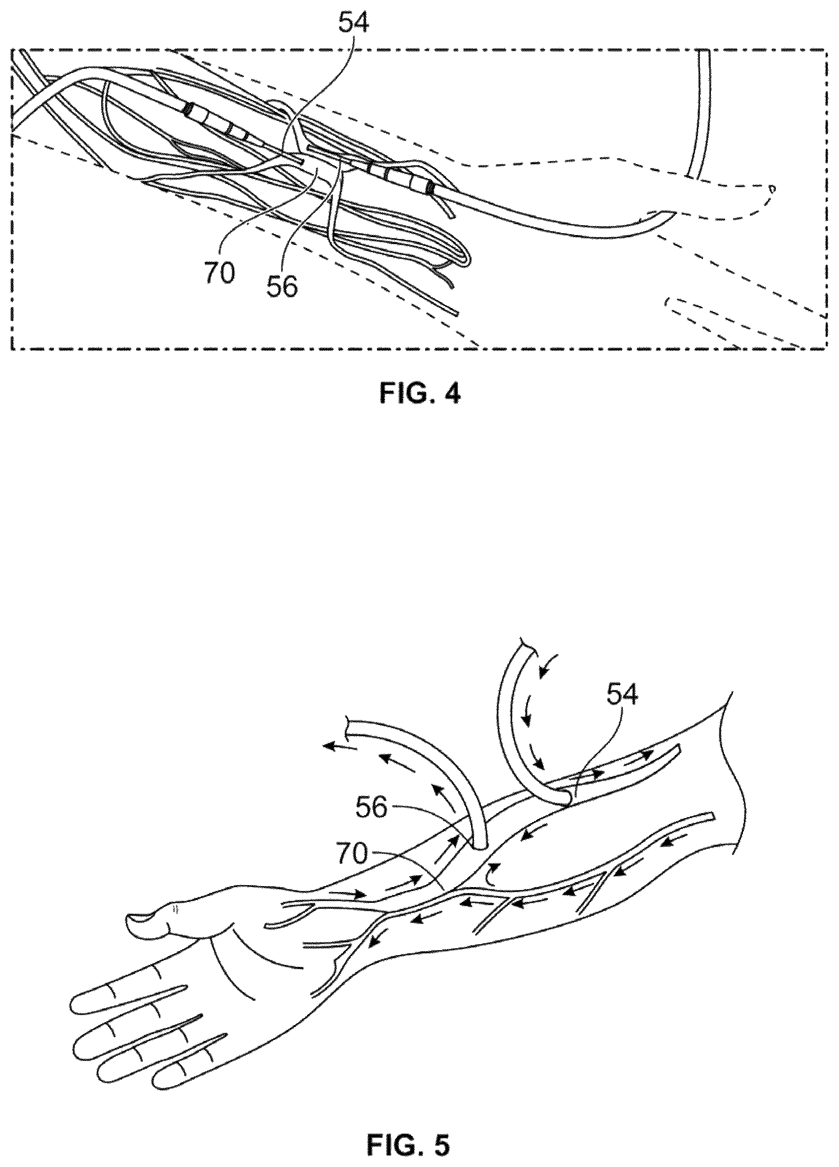 Patent US12508375 Figure 3 – Vascular access device and methods