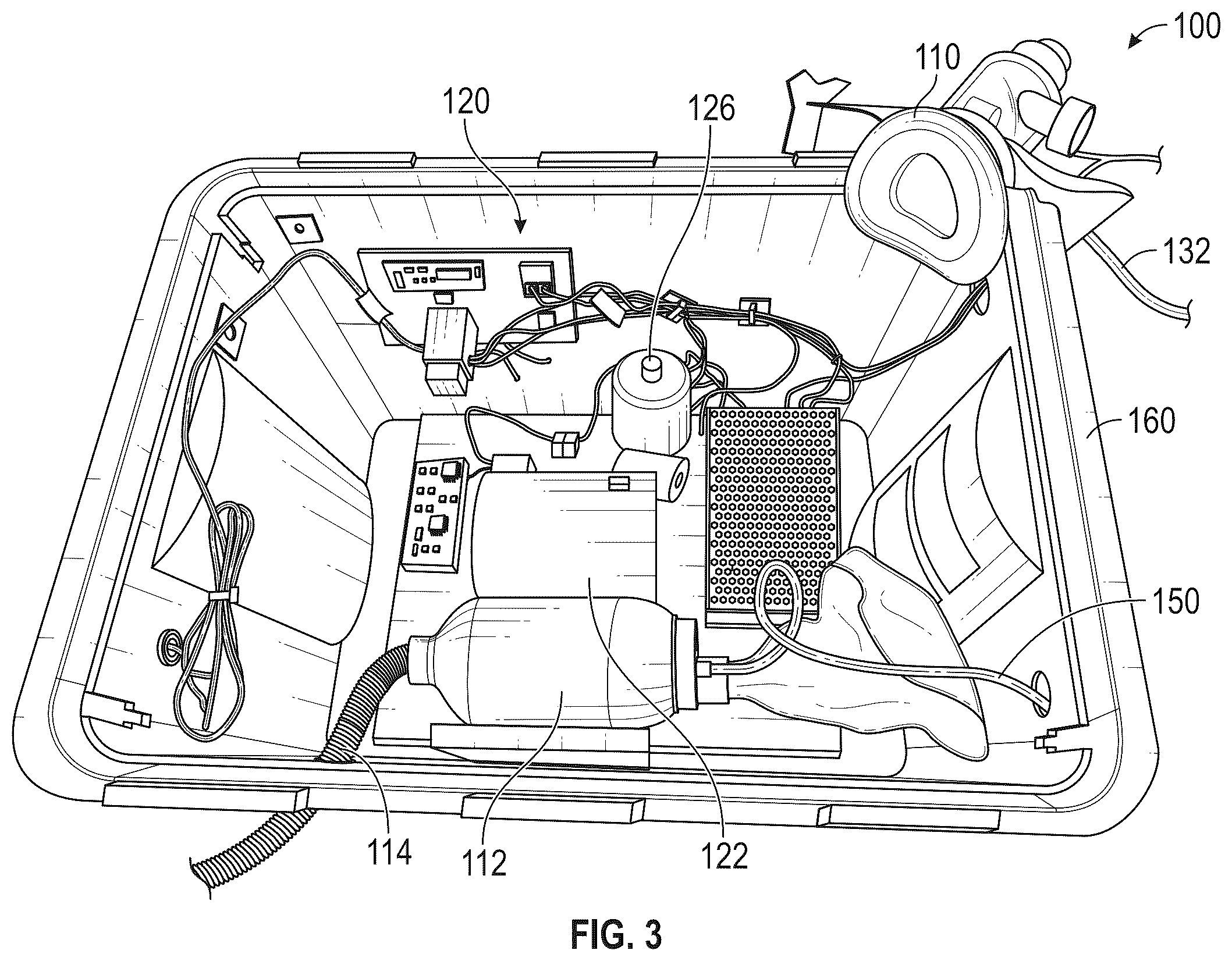 Patent US12508378 Figure 3 – Breathe assist system and breathe assist control system