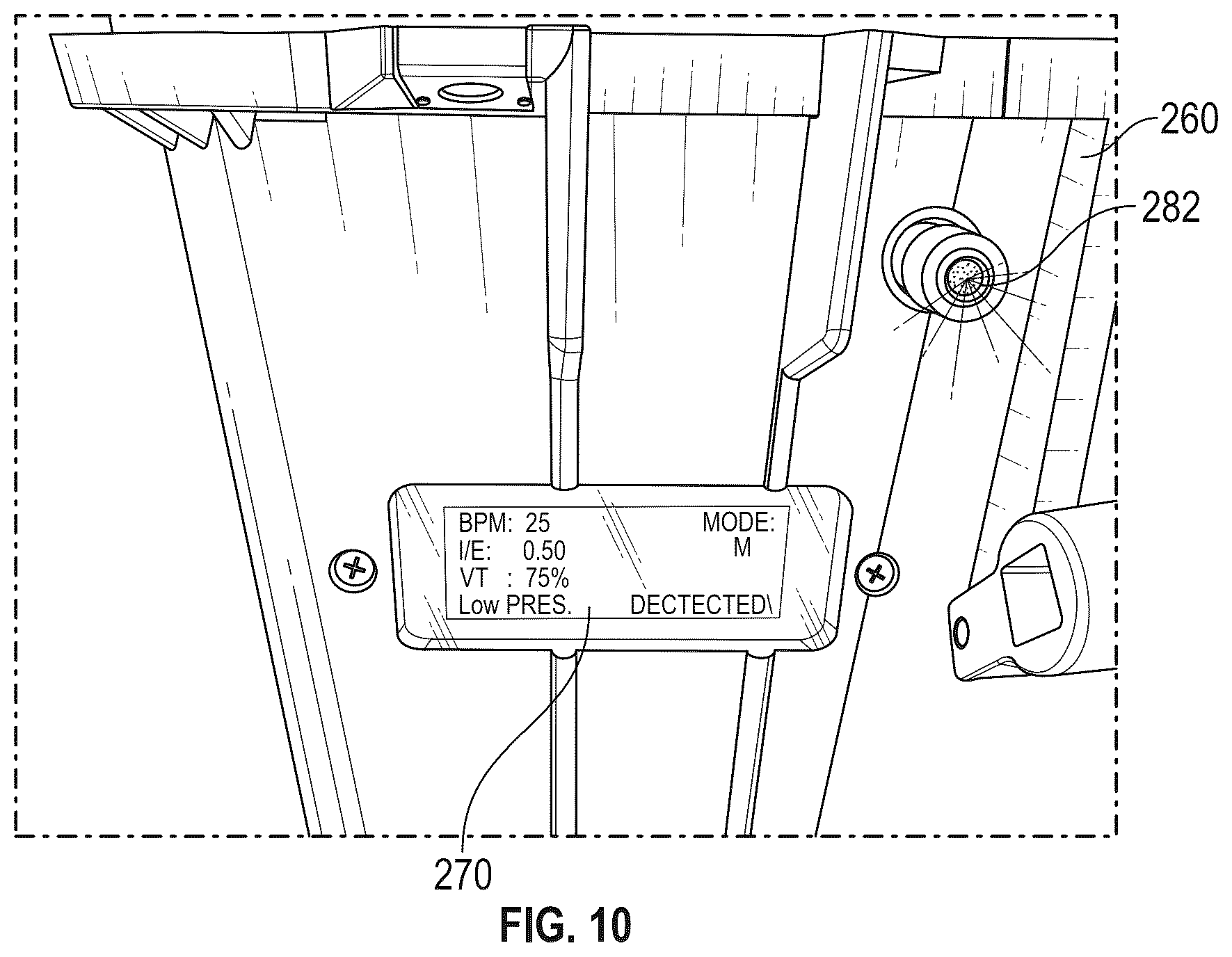 Patent US12508378 Figure 9 – Breathe assist system and breathe assist control system