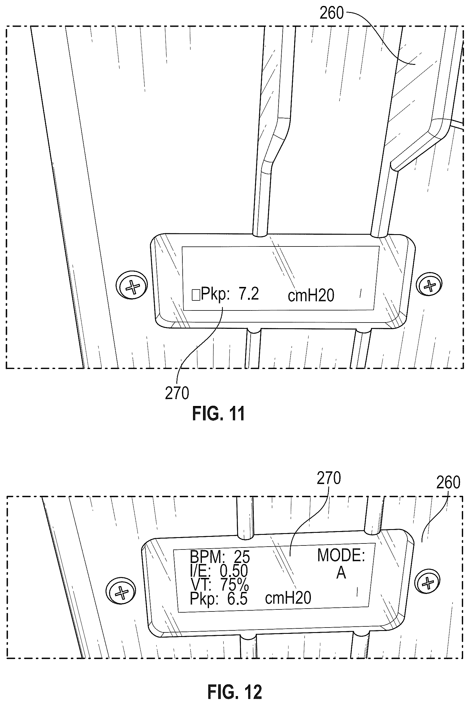 Patent US12508378 Figure 10 – Breathe assist system and breathe assist control system