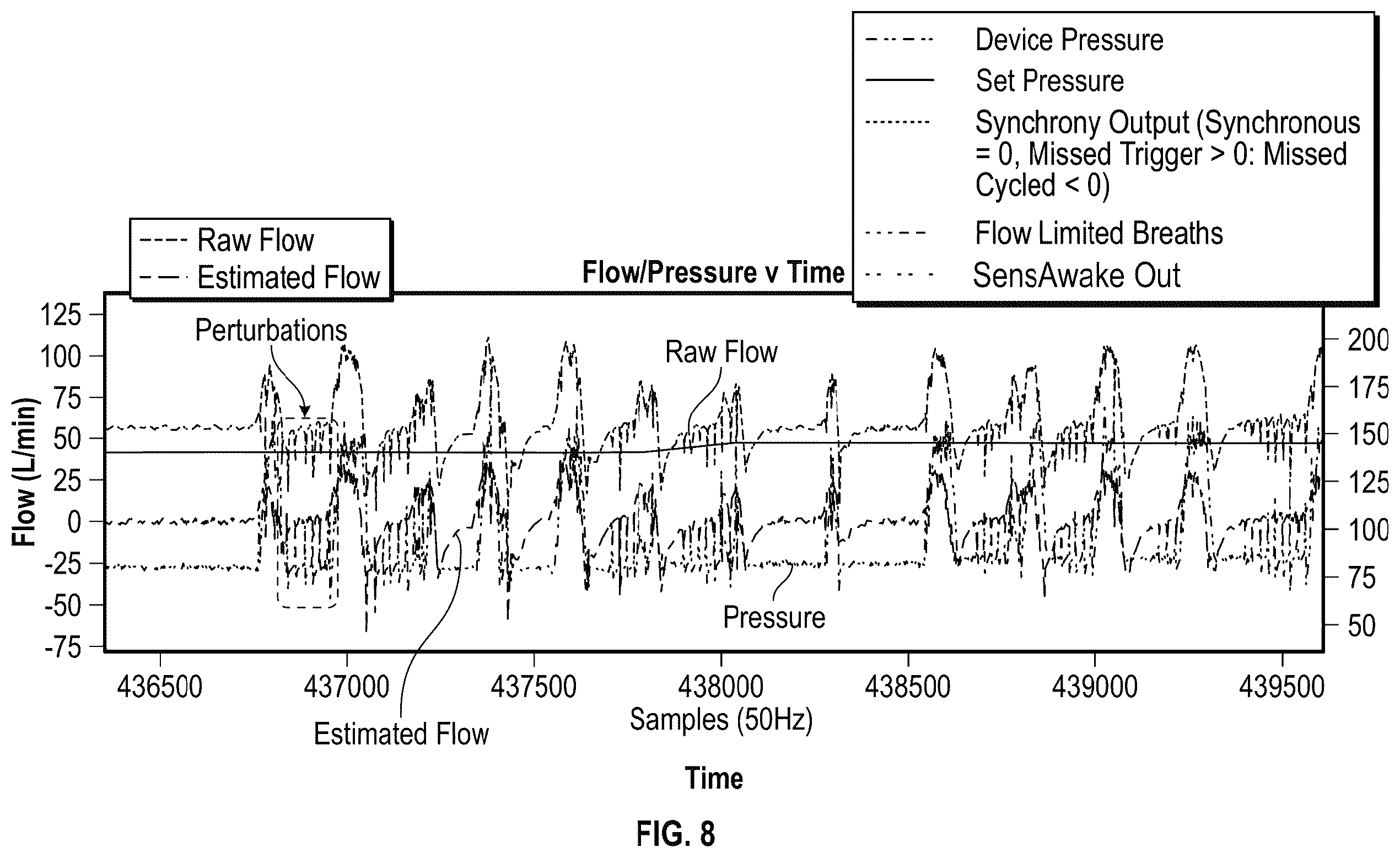 Patent US12508379 Figure 17 – System and method of detection of water in a conduit for use in a respiratory therapy system