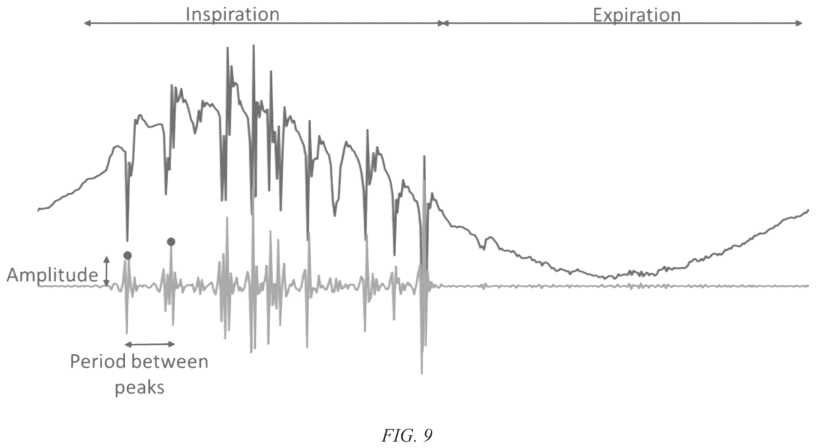 Patent US12508379 Figure 18 – System and method of detection of water in a conduit for use in a respiratory therapy system