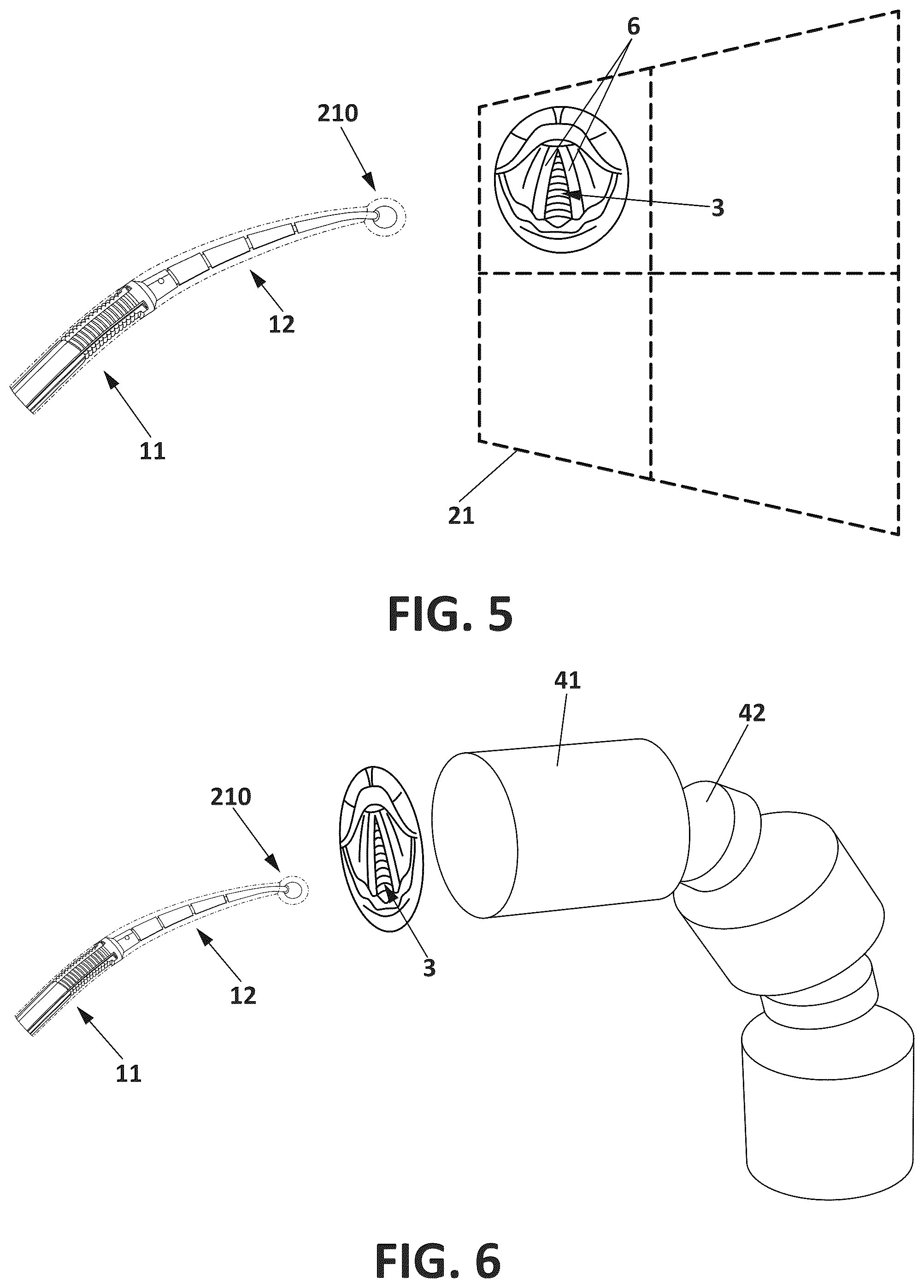 Patent US12508380 Figure 4 – Intubation bougie