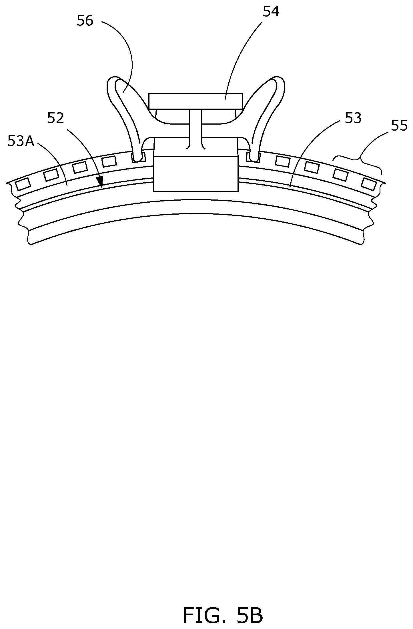 Patent US12508381 Figure 6 – Apparatus and method for an endotracheal tube holder