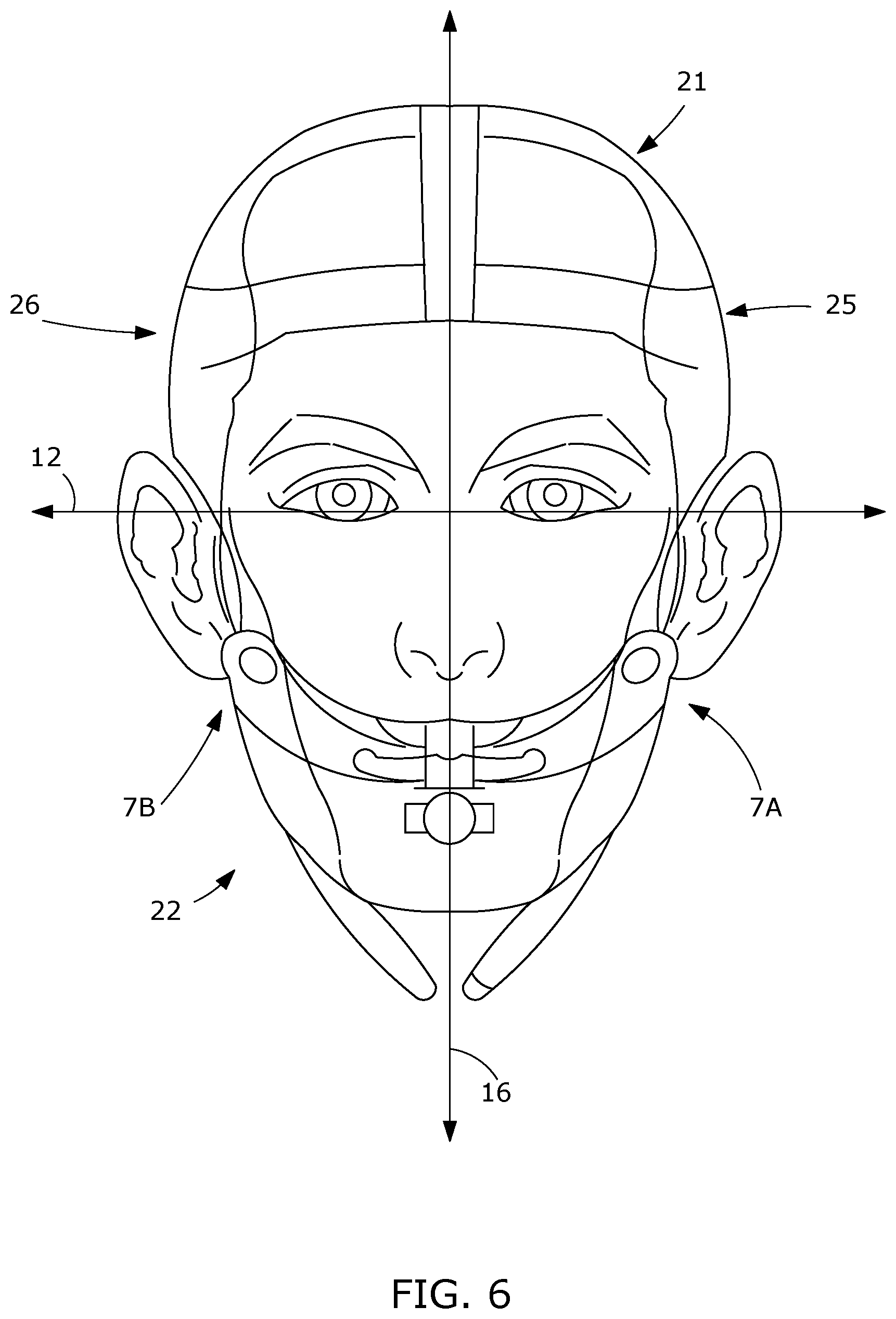 Patent US12508381 Figure 9 – Apparatus and method for an endotracheal tube holder