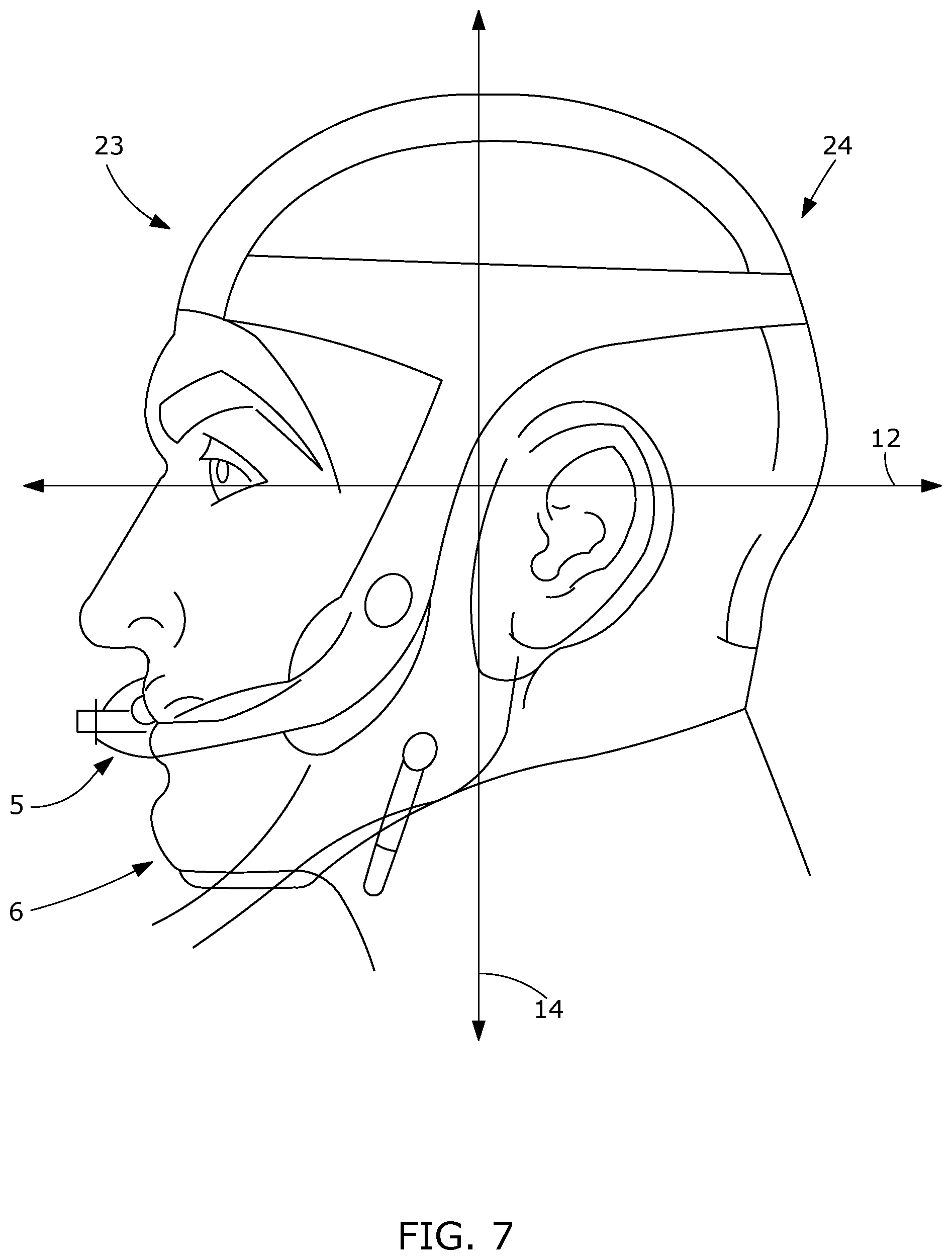 Patent US12508381 Figure 10 – Apparatus and method for an endotracheal tube holder