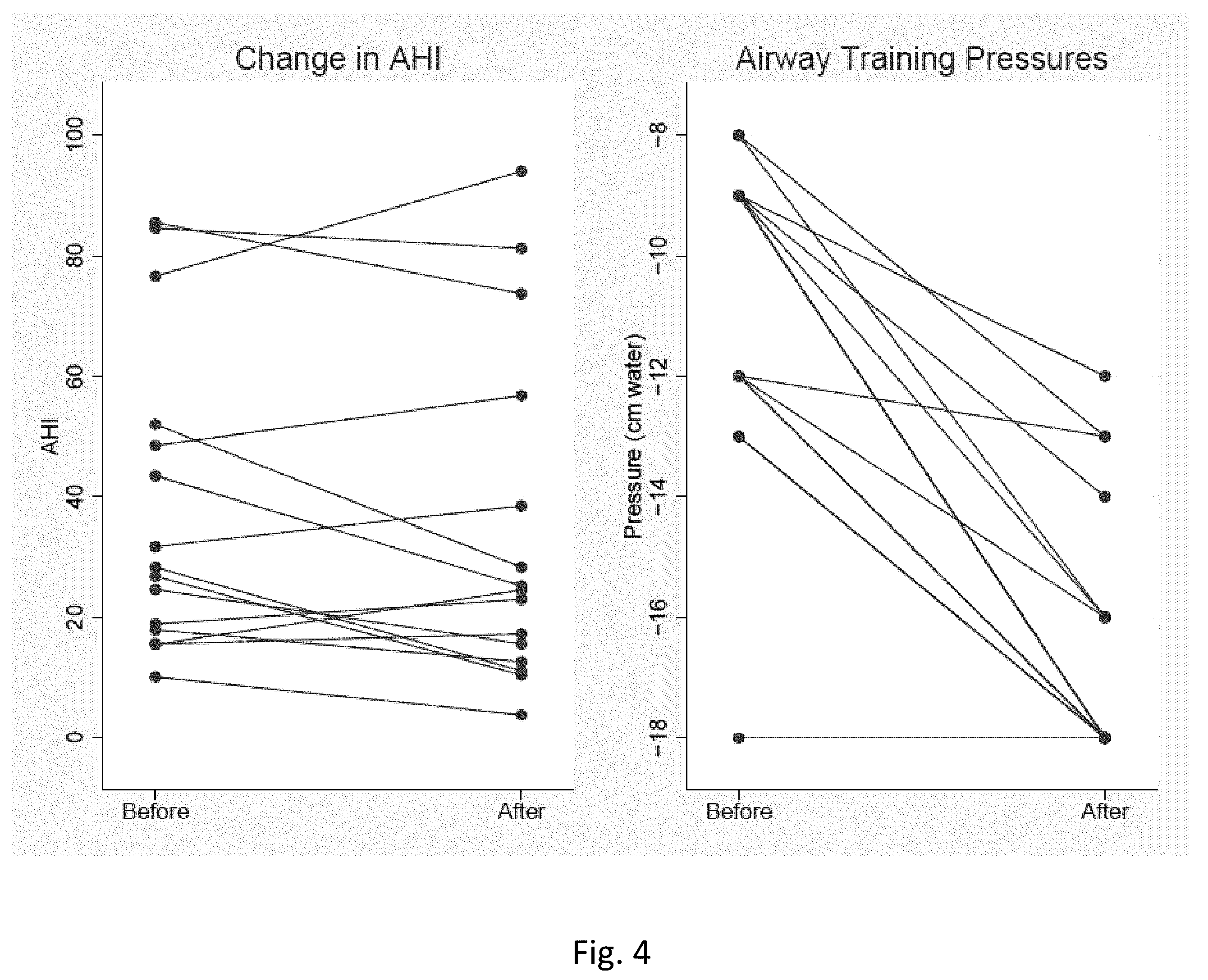 Patent US12508382 Figure 4 – Myofunctional training with negative airway pressure for obstructive sleep apnea