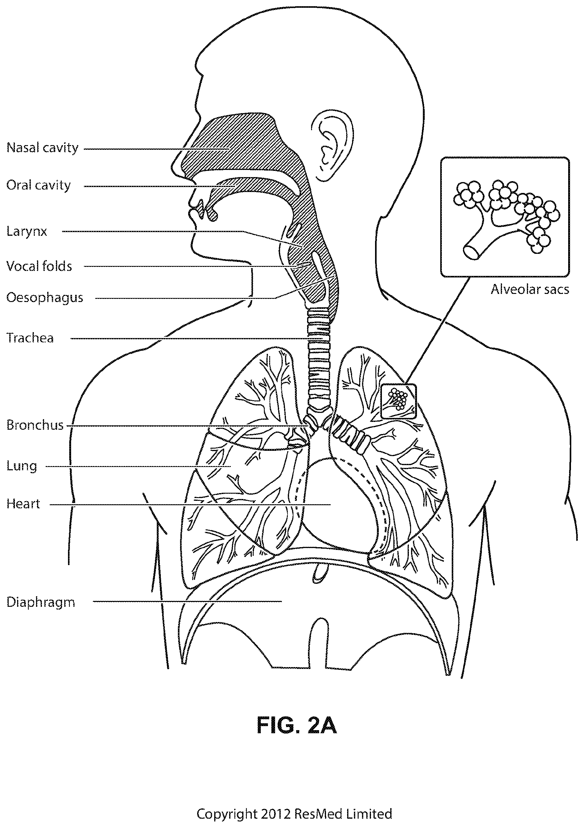 Patent US12508384 Figure 4 – Cushion module for a patient interface