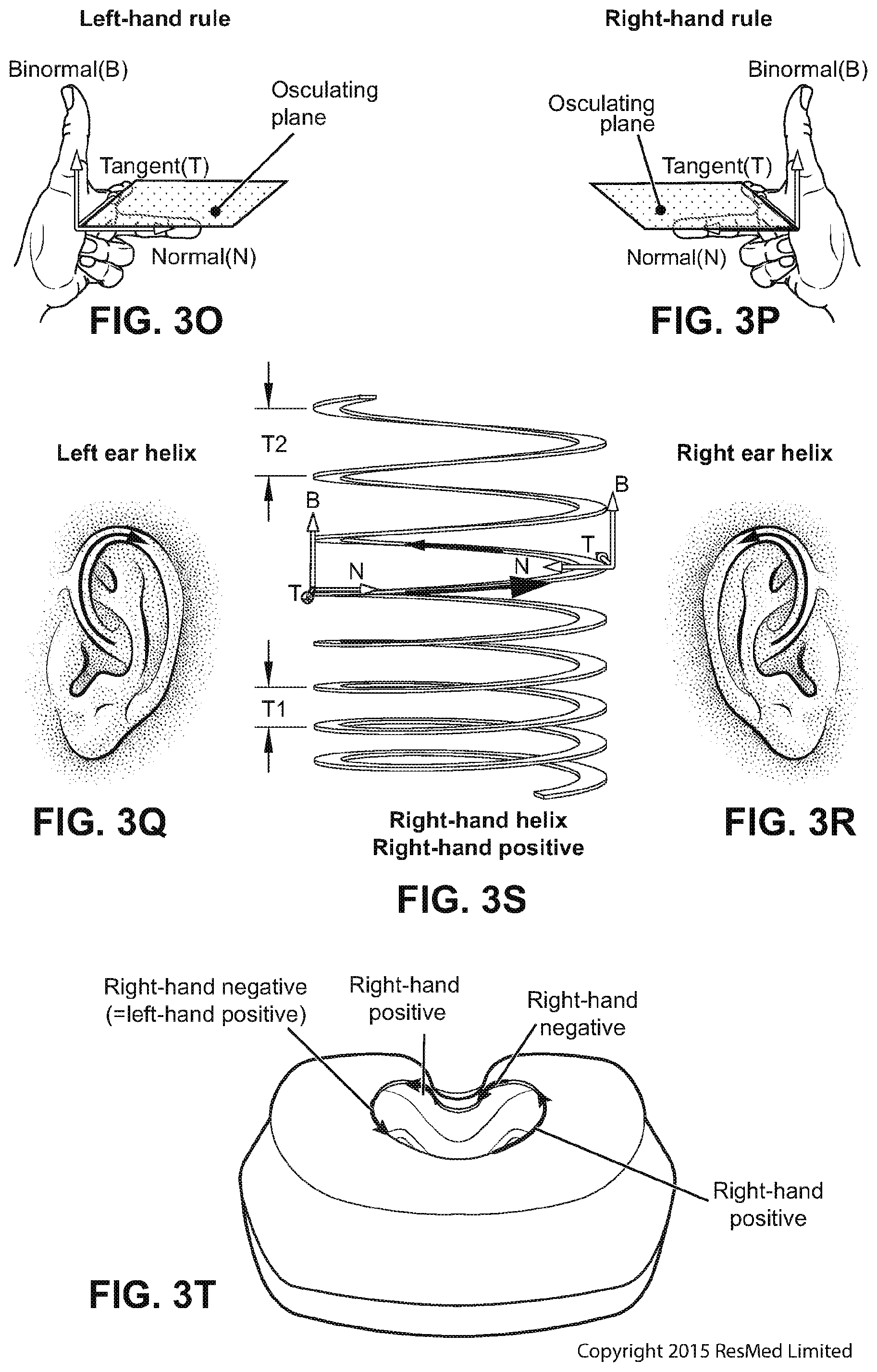 Patent US12508384 Figure 17 – Cushion module for a patient interface
