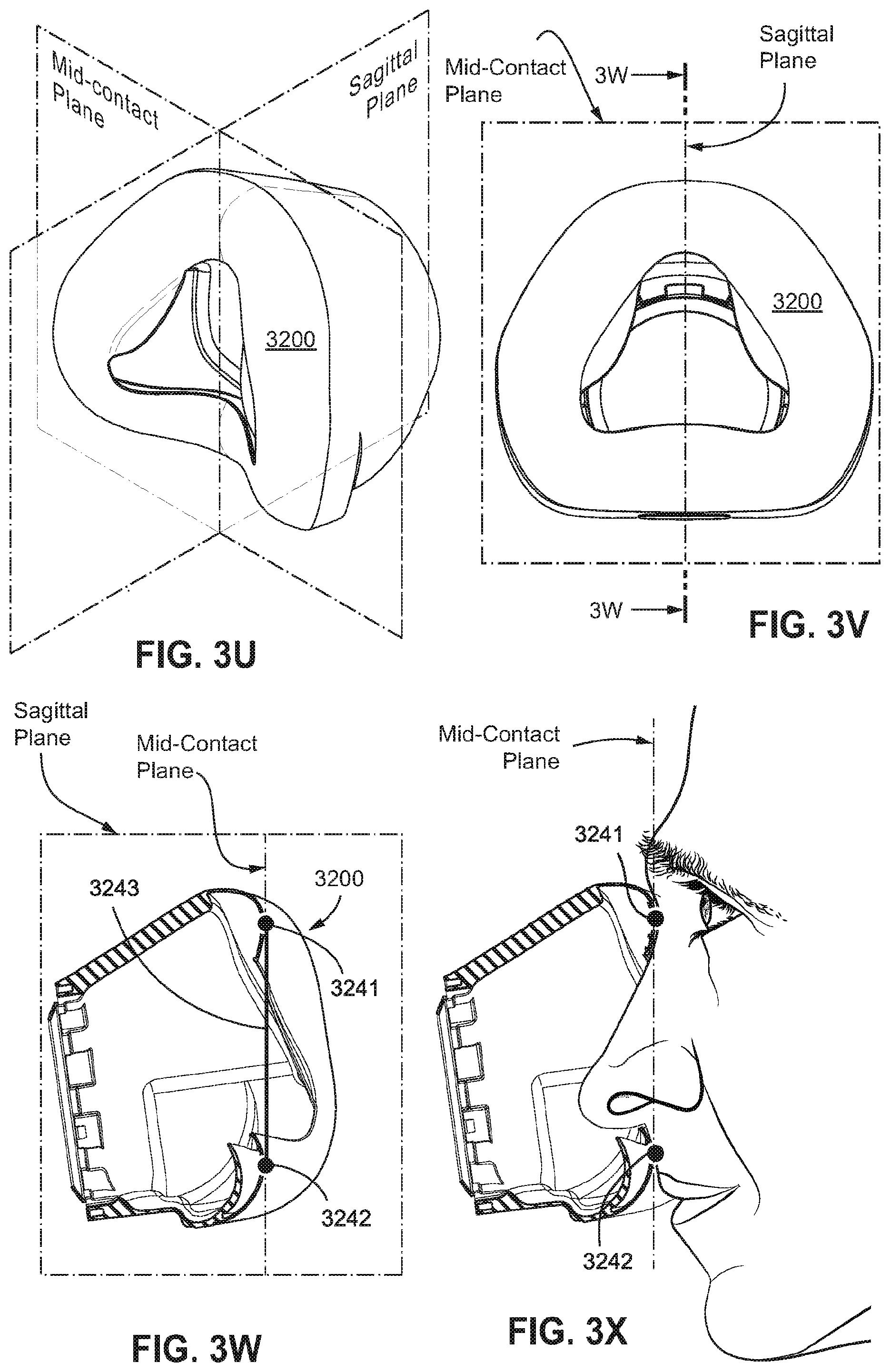 Patent US12508384 Figure 18 – Cushion module for a patient interface