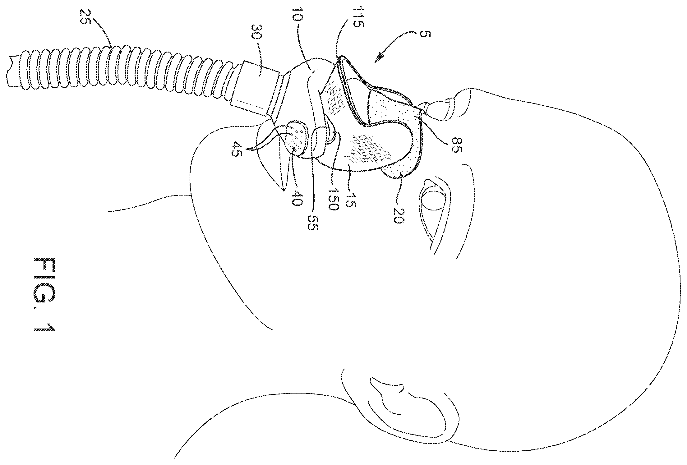 Patent US12508387 Figure 1 – Patient interface systems