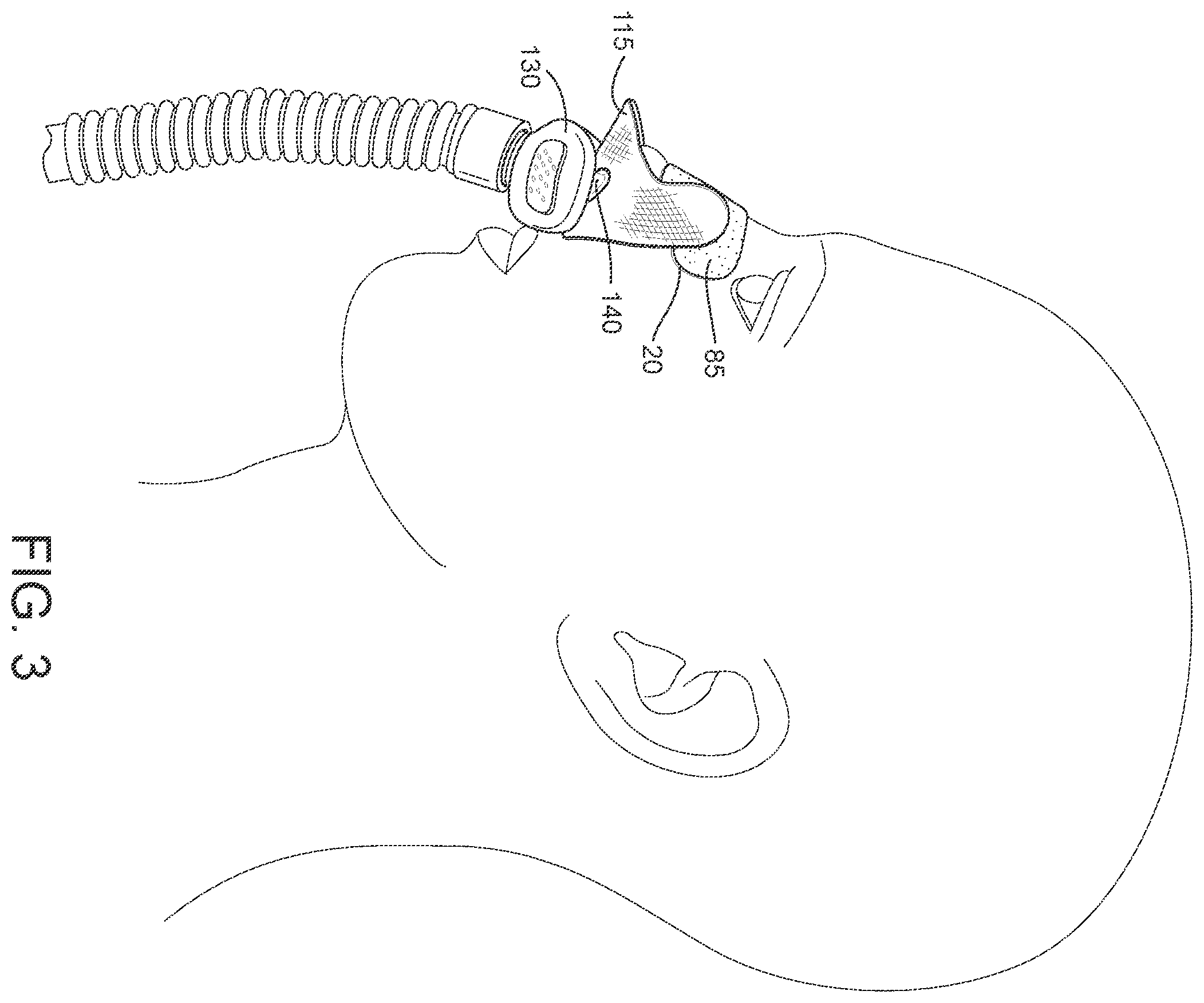 Patent US12508387 Figure 3 – Patient interface systems