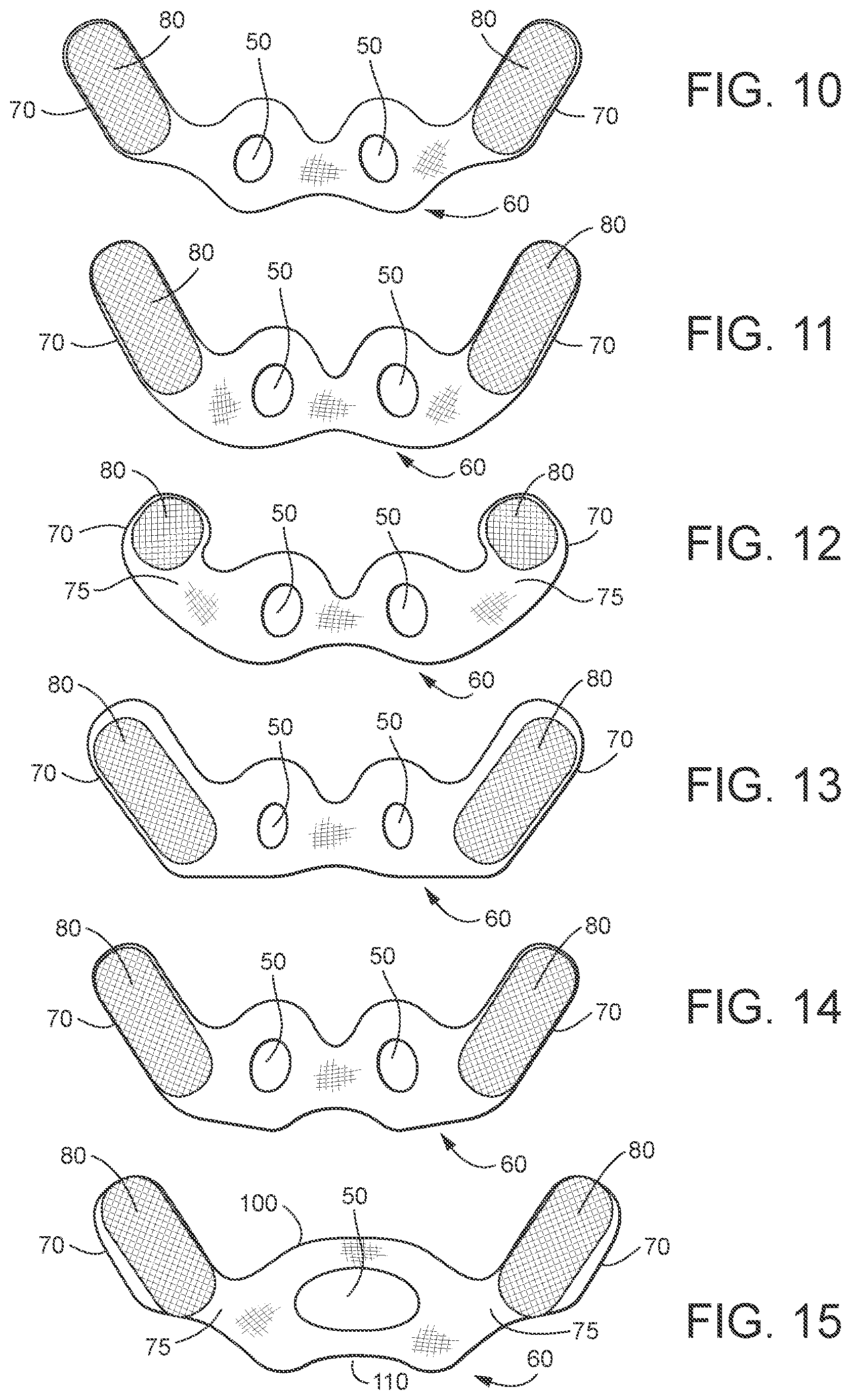 Patent US12508387 Figure 9 – Patient interface systems