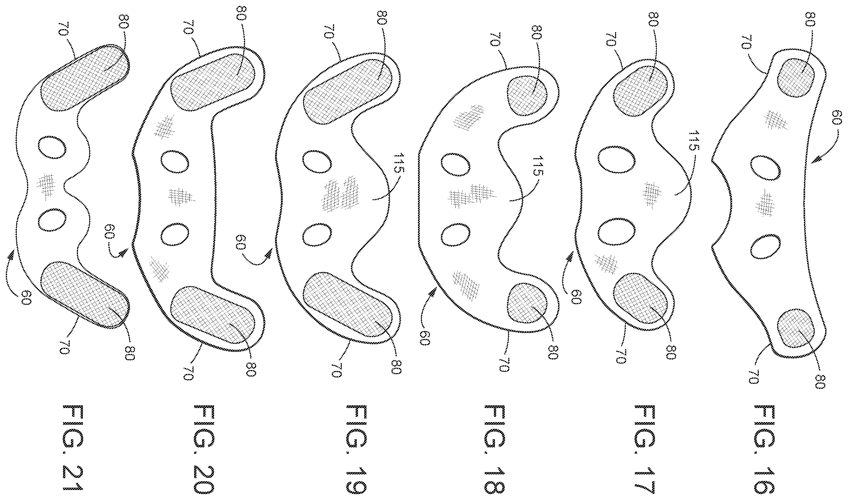 Patent US12508387 Figure 10 – Patient interface systems