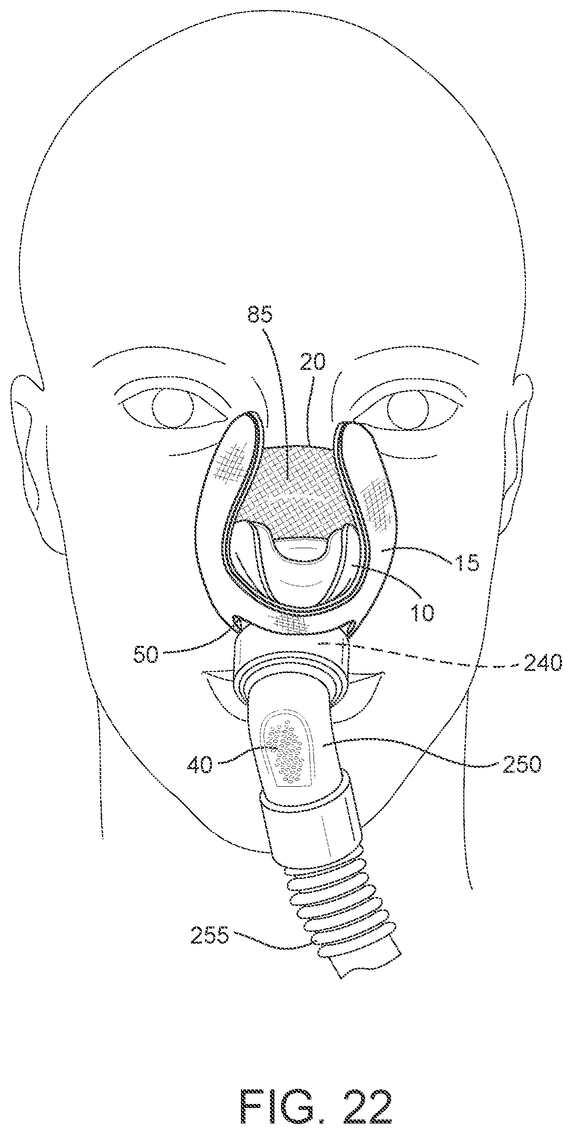Patent US12508387 Figure 11 – Patient interface systems