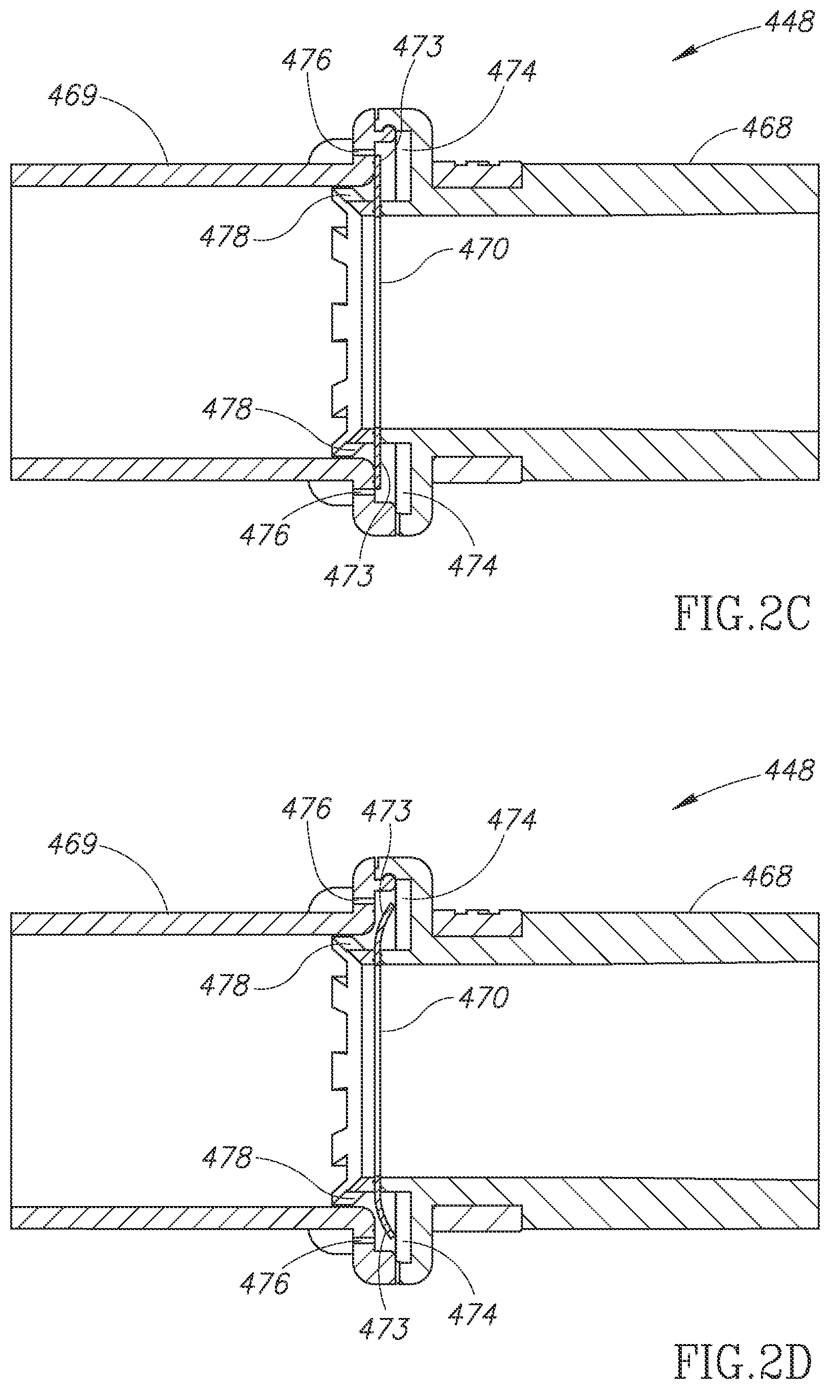 Patent US12508389 Figure 3 – Respiratory therapy systems and methods