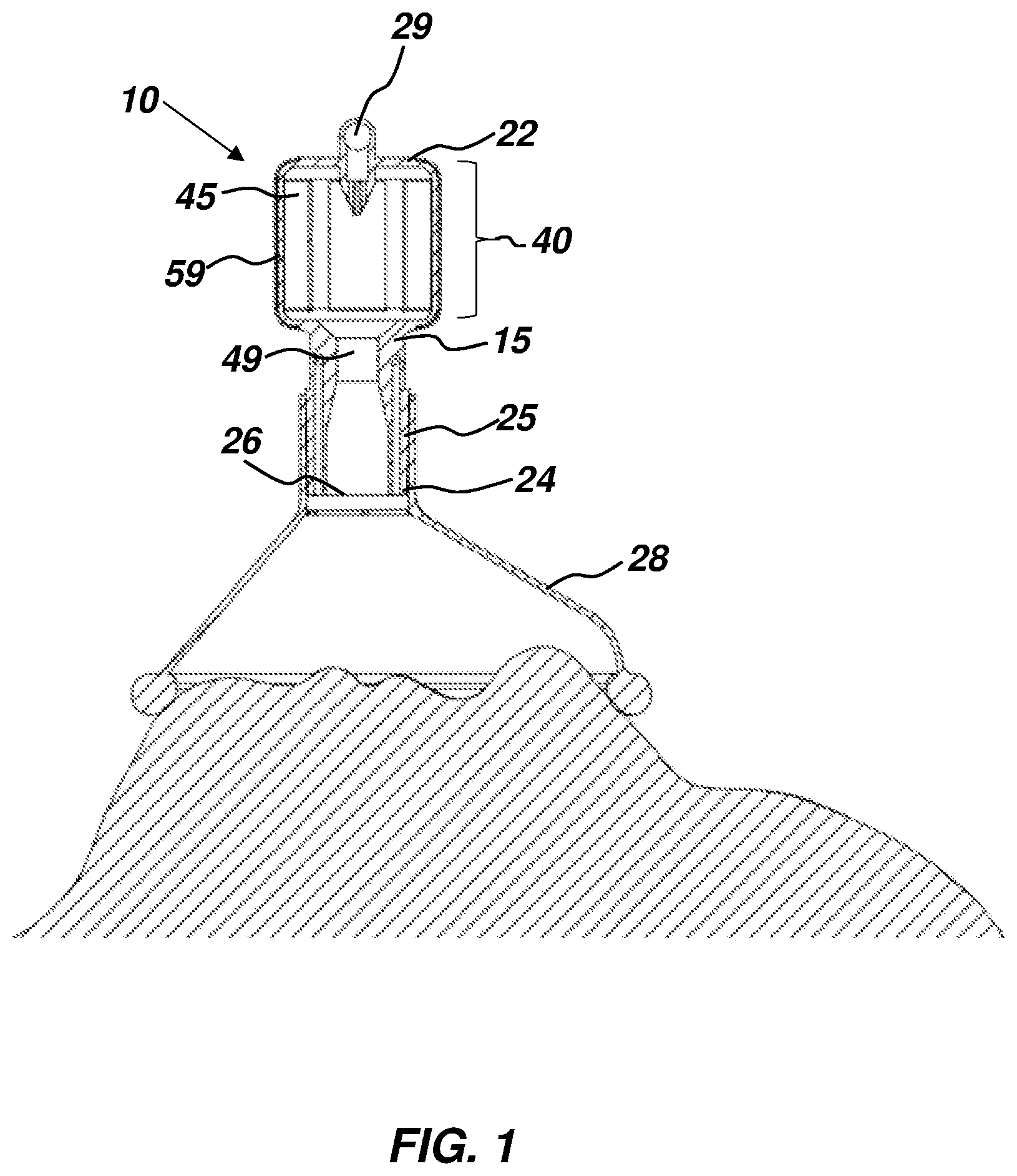 Patent US12508390 — Respiratory fluid flow control device and method of using same — Figure 1