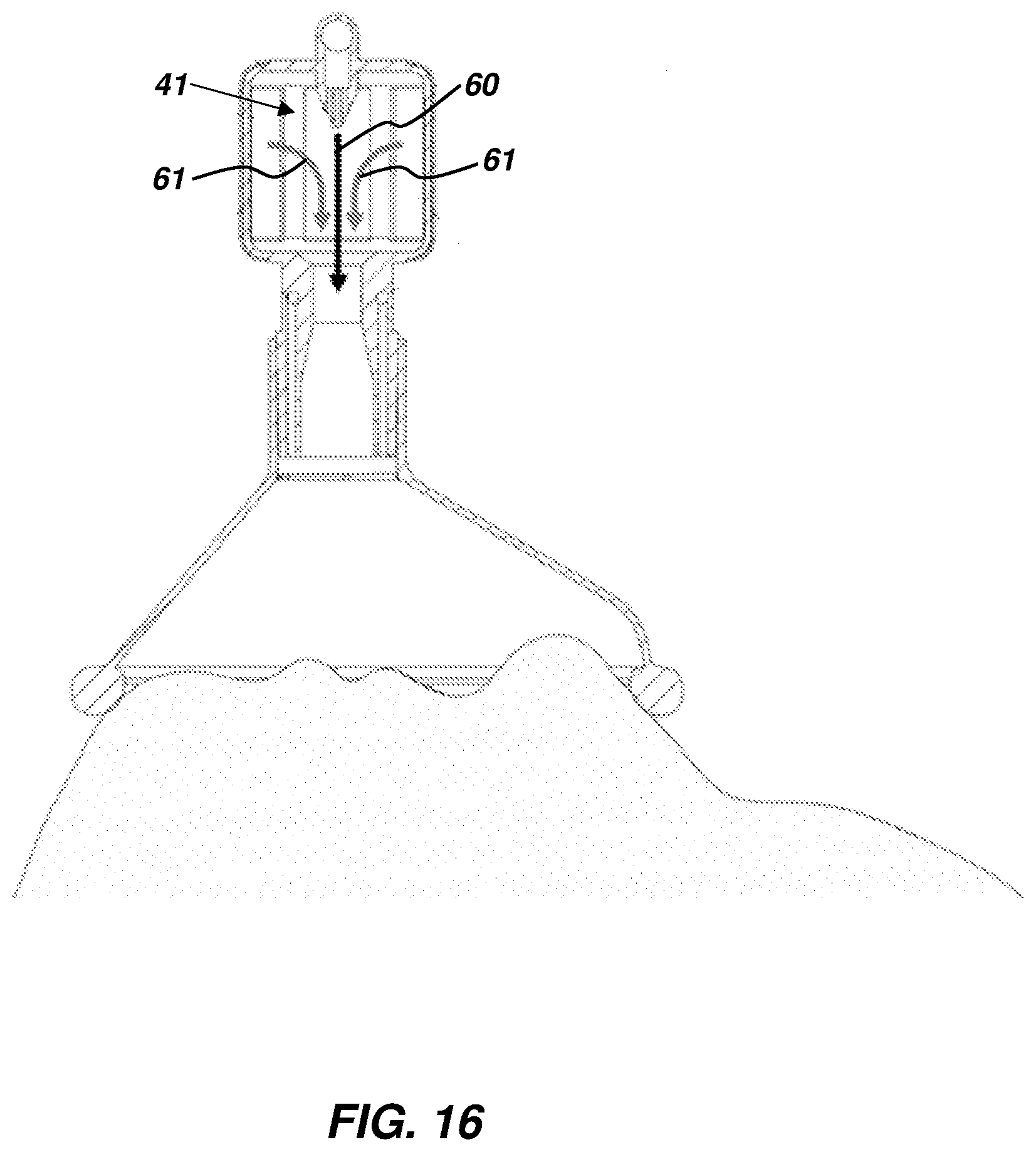 Patent US12508390 Figure 8 – Respiratory fluid flow control device and method of using same