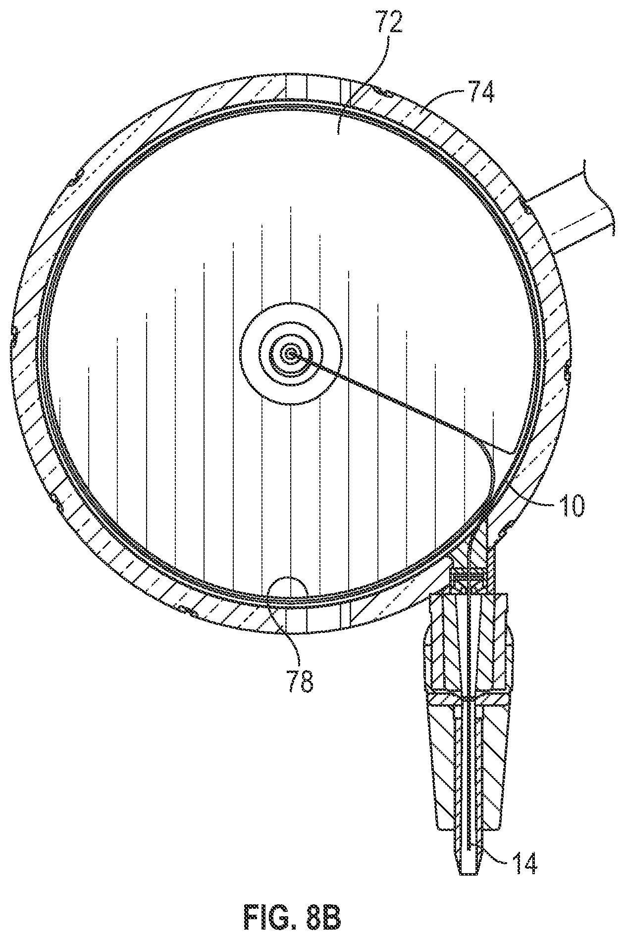 Patent US12508397 Figure 9 – Tubular instrument and related devices and methods