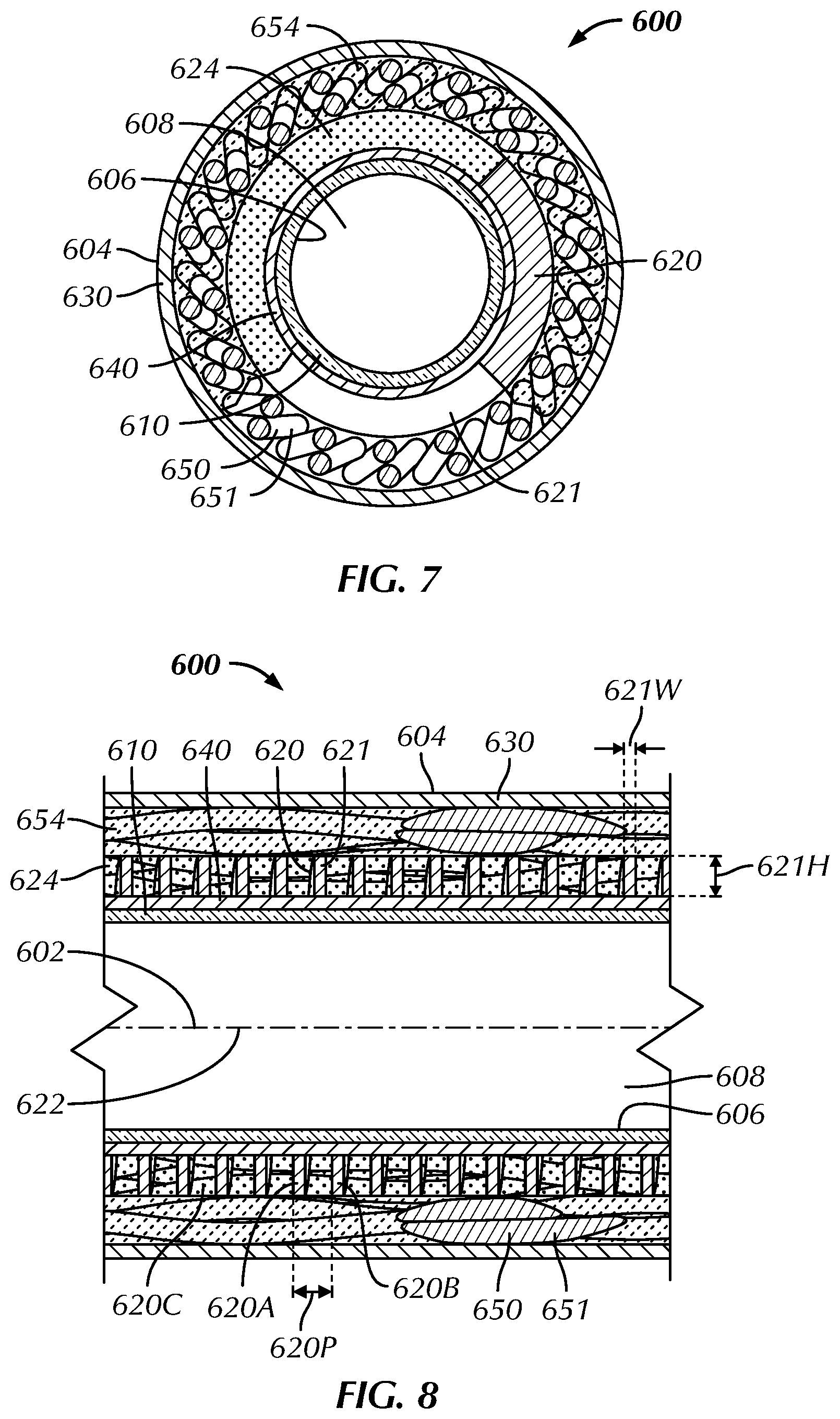 Patent US12508398 Figure 5 – Medical device including shaft with flat wire coil