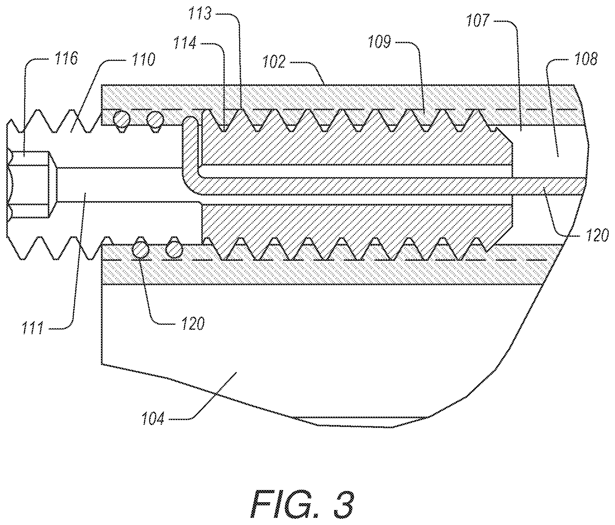 Patent US12508399 Figure 3 – Manufacture of steerable delivery devices