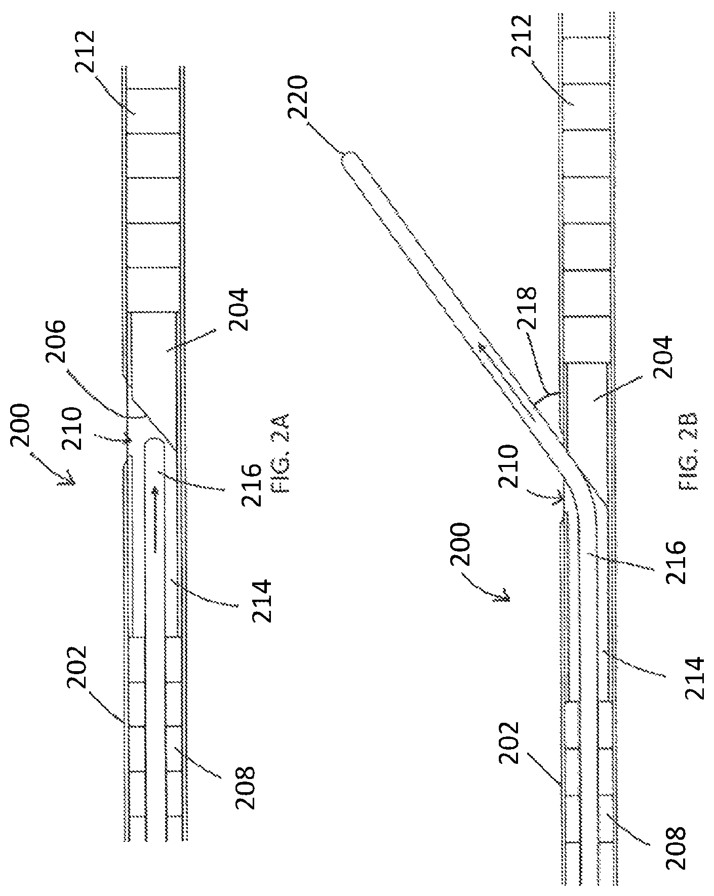 Patent US12508400 Figure 2 – Devices and methods for advancing a wire